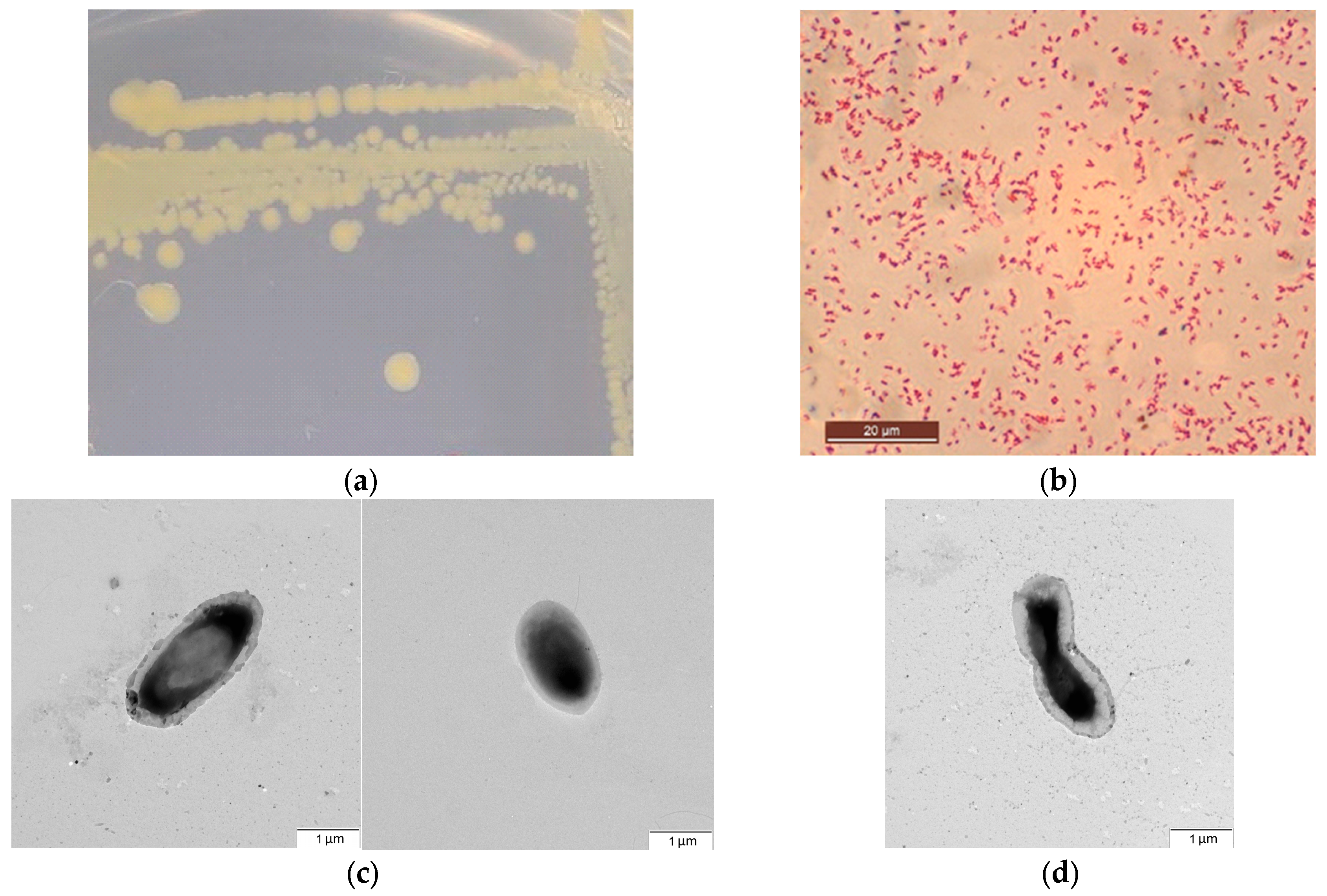 Microorganisms 13 00474 g003 Microorganisms 13 00474 g003