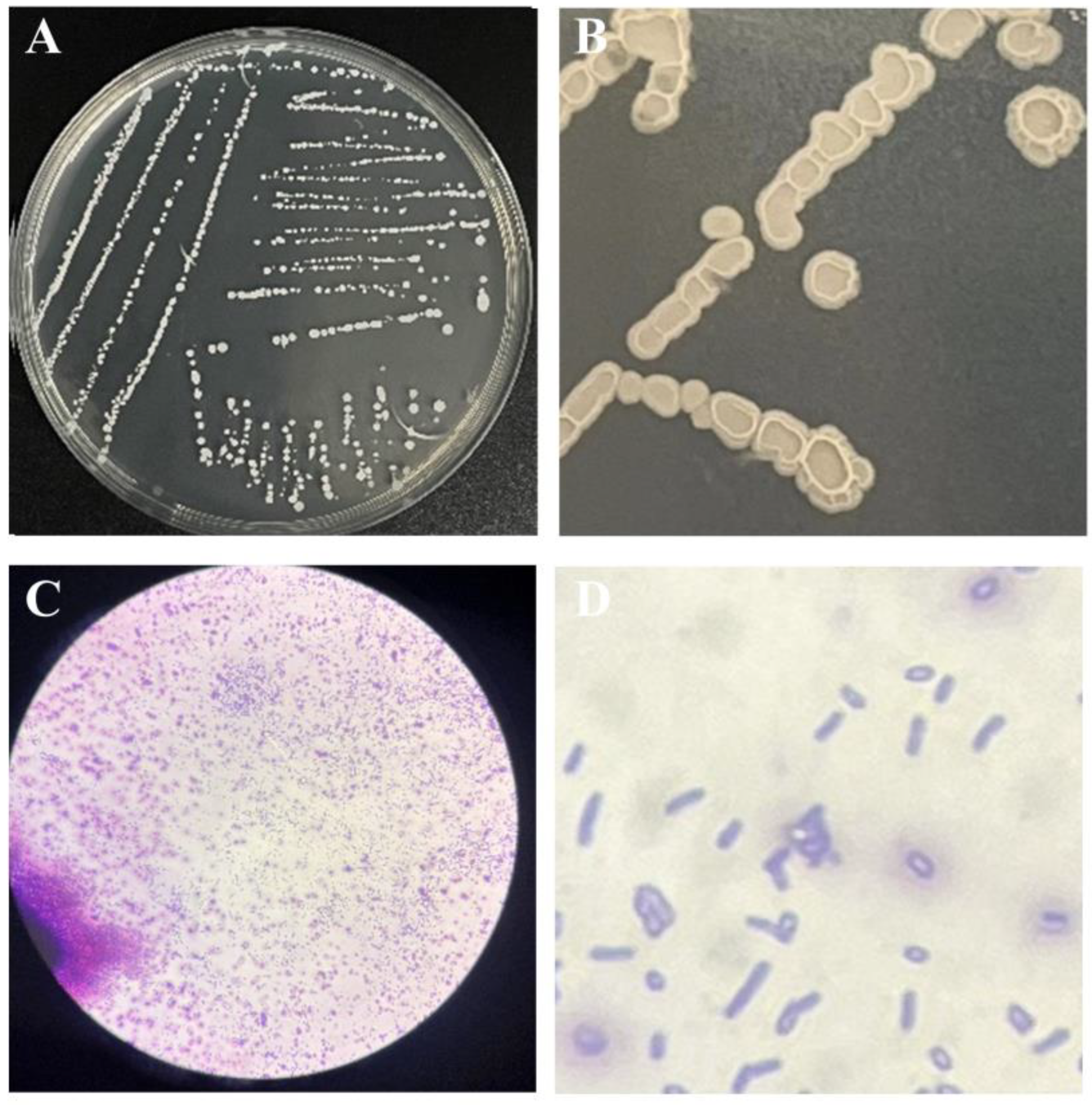 Microorganisms 13 00560 g001