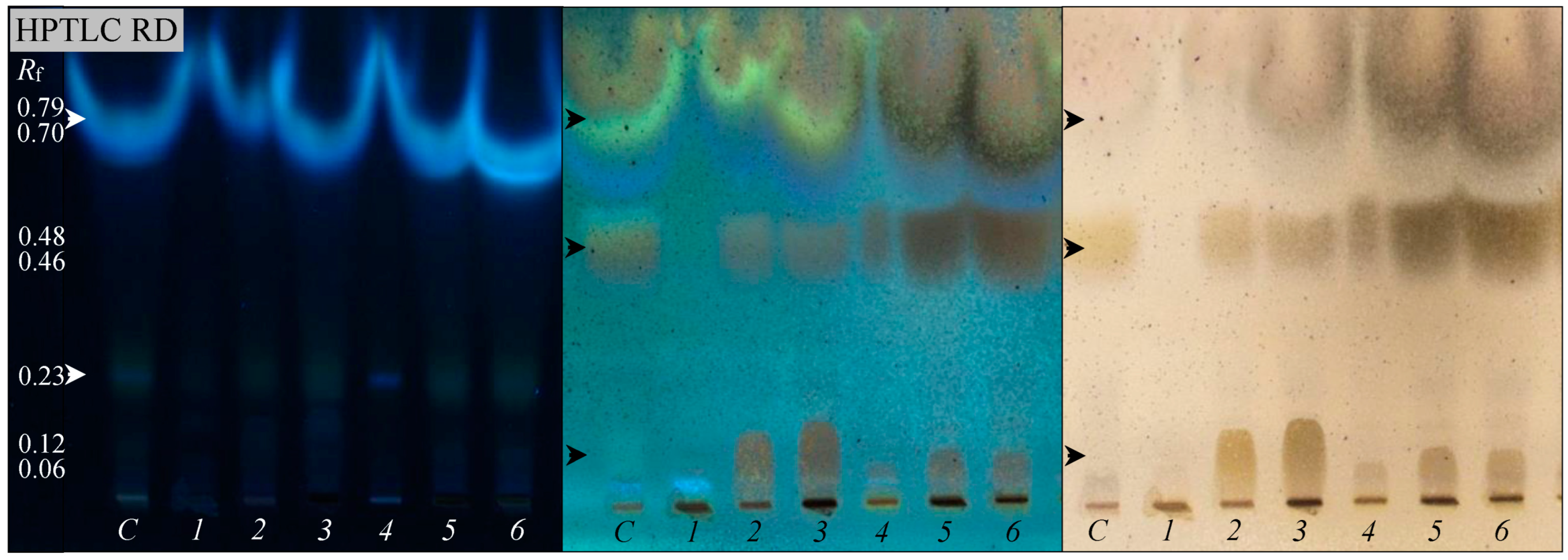 Microorganisms 13 00564 g005