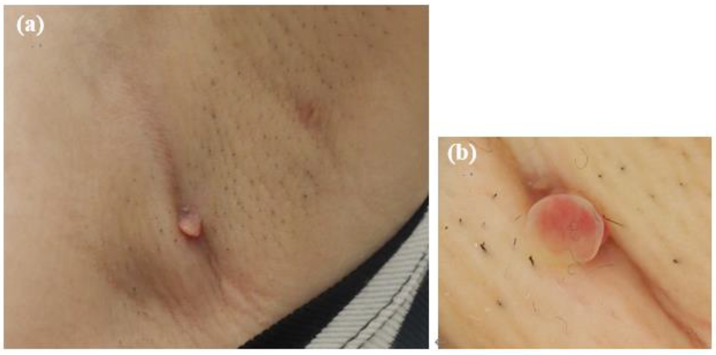 Microorganisms 13 00671 g001