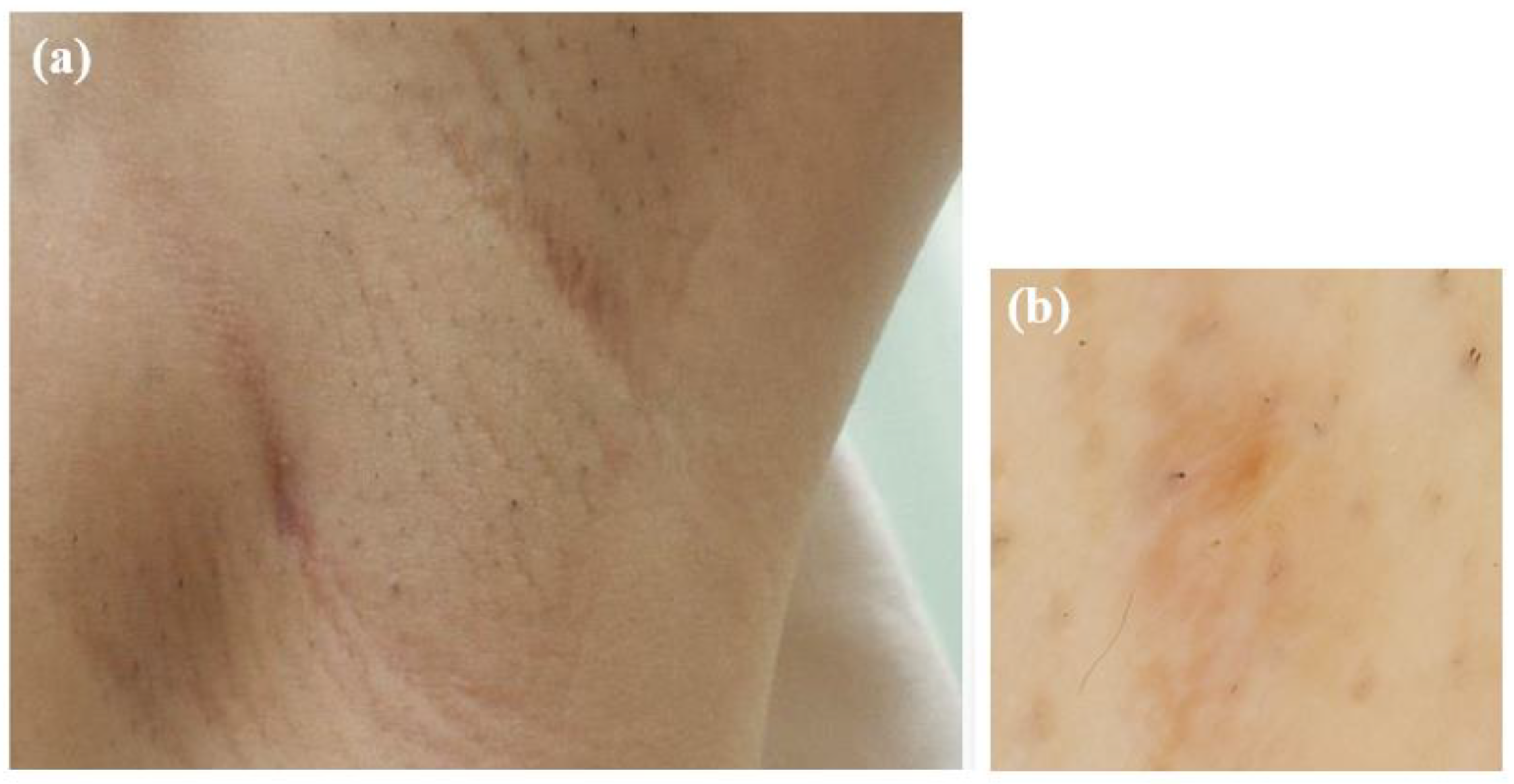 Microorganisms 13 00671 g006