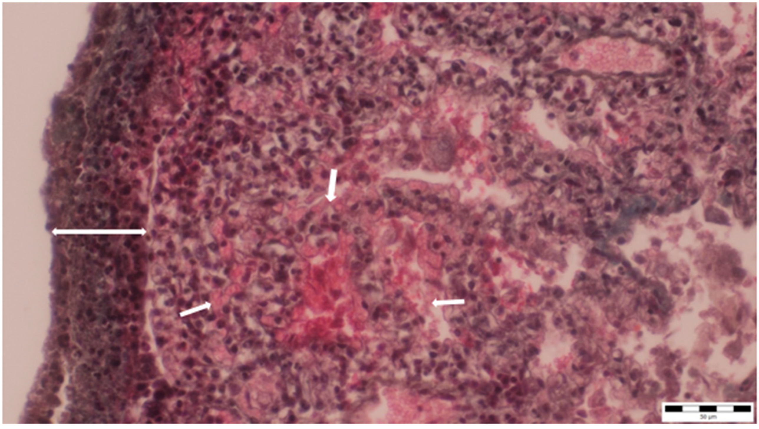 Microorganisms 13 00769 g006