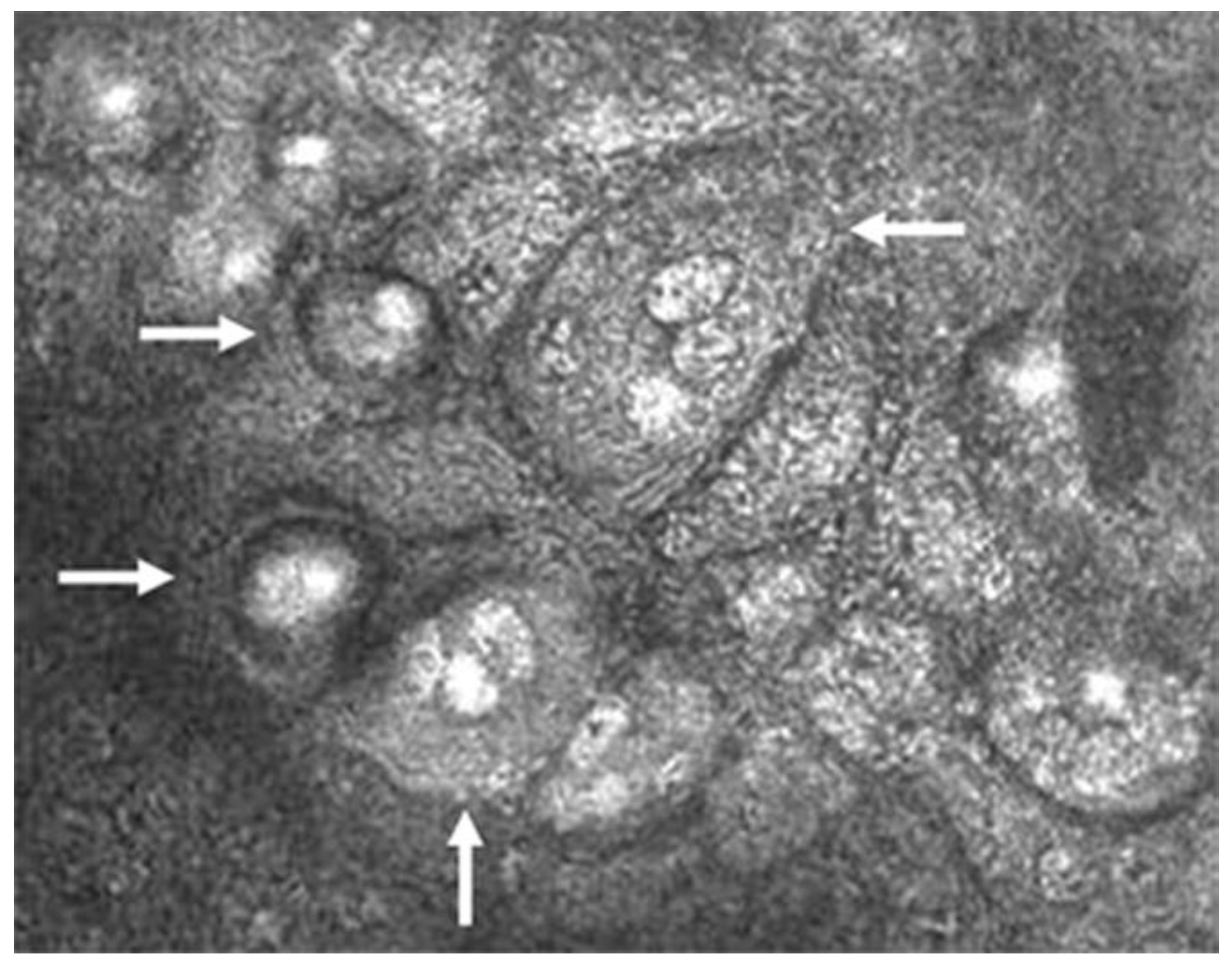 Microorganisms 13 00778 g004
