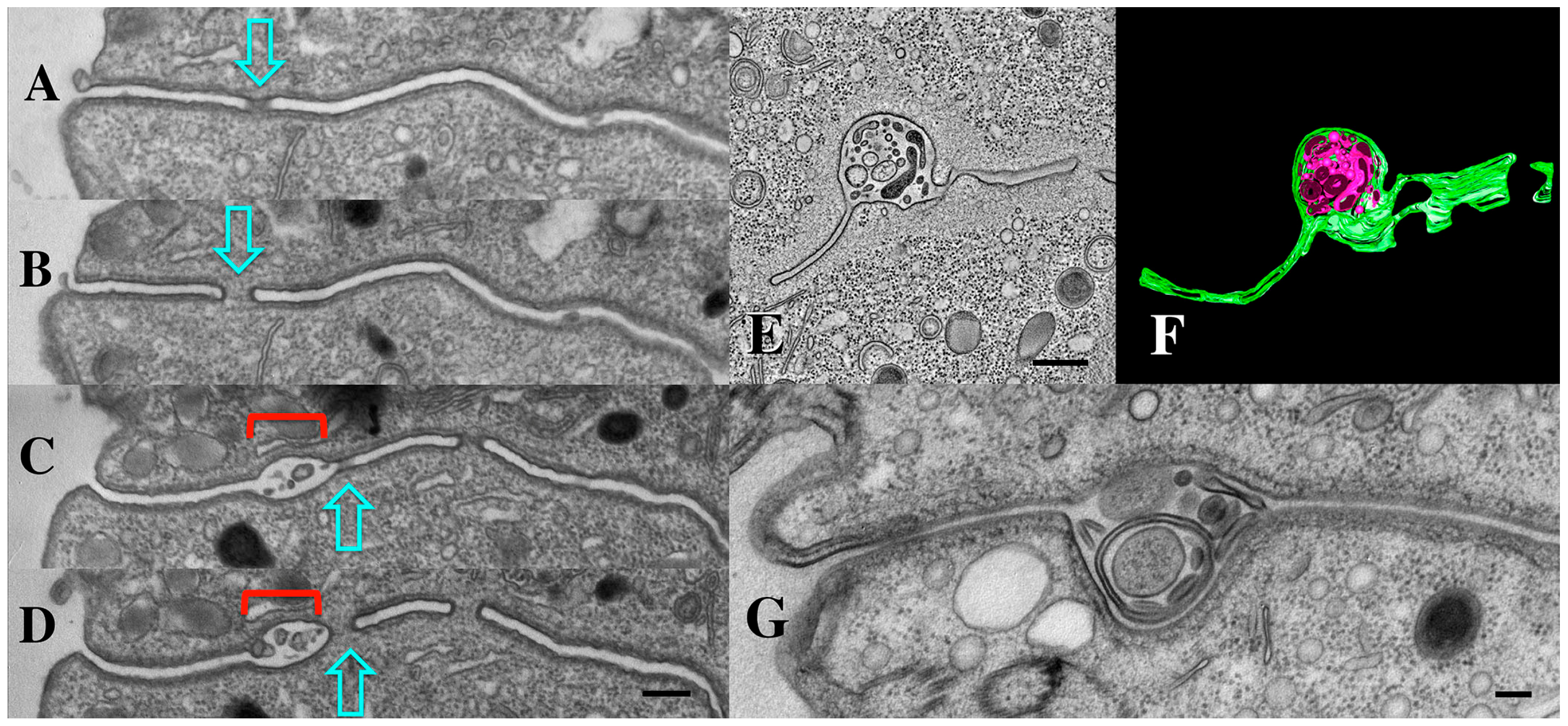 Microorganisms 13 00803 g011