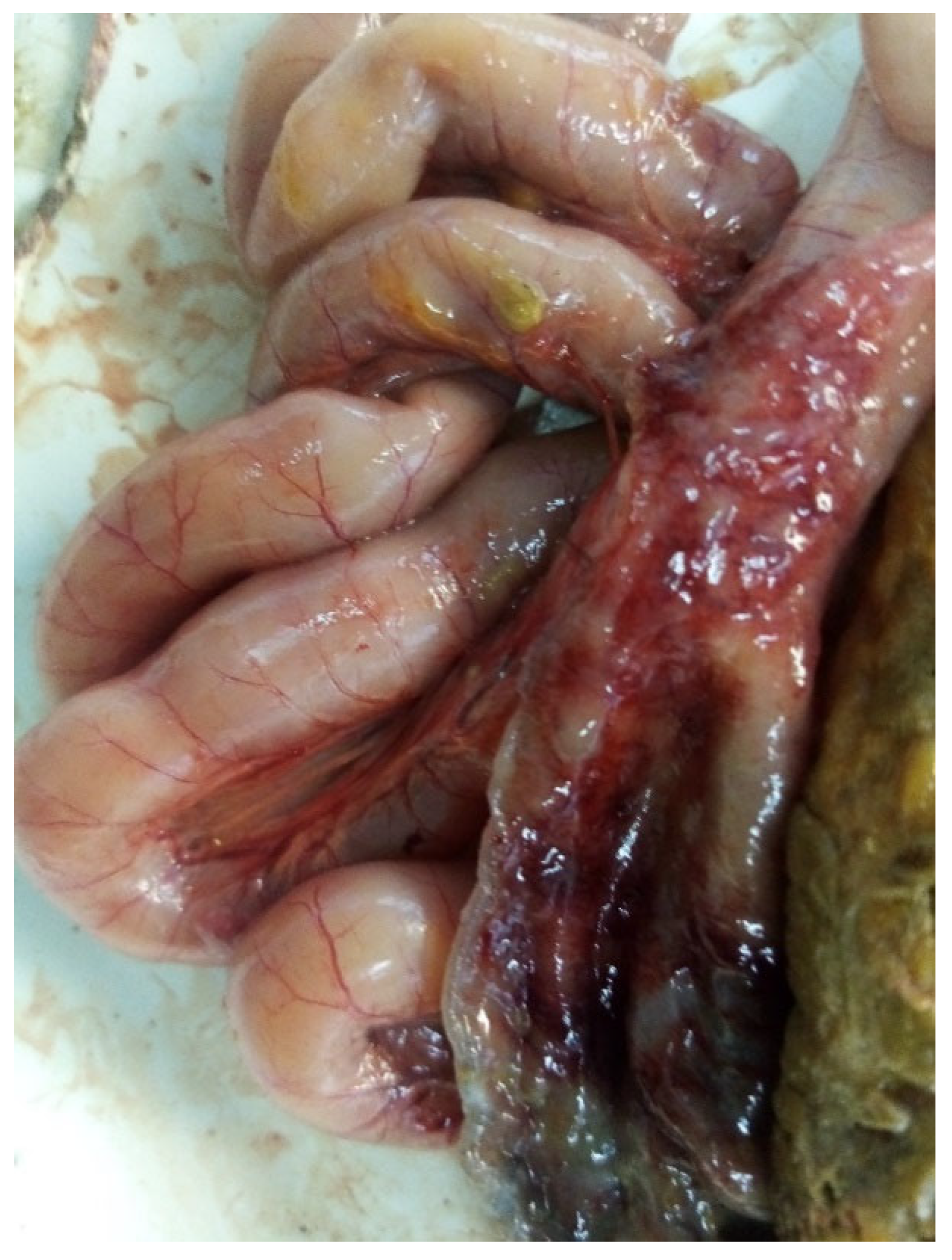 Microorganisms 13 00816 g001