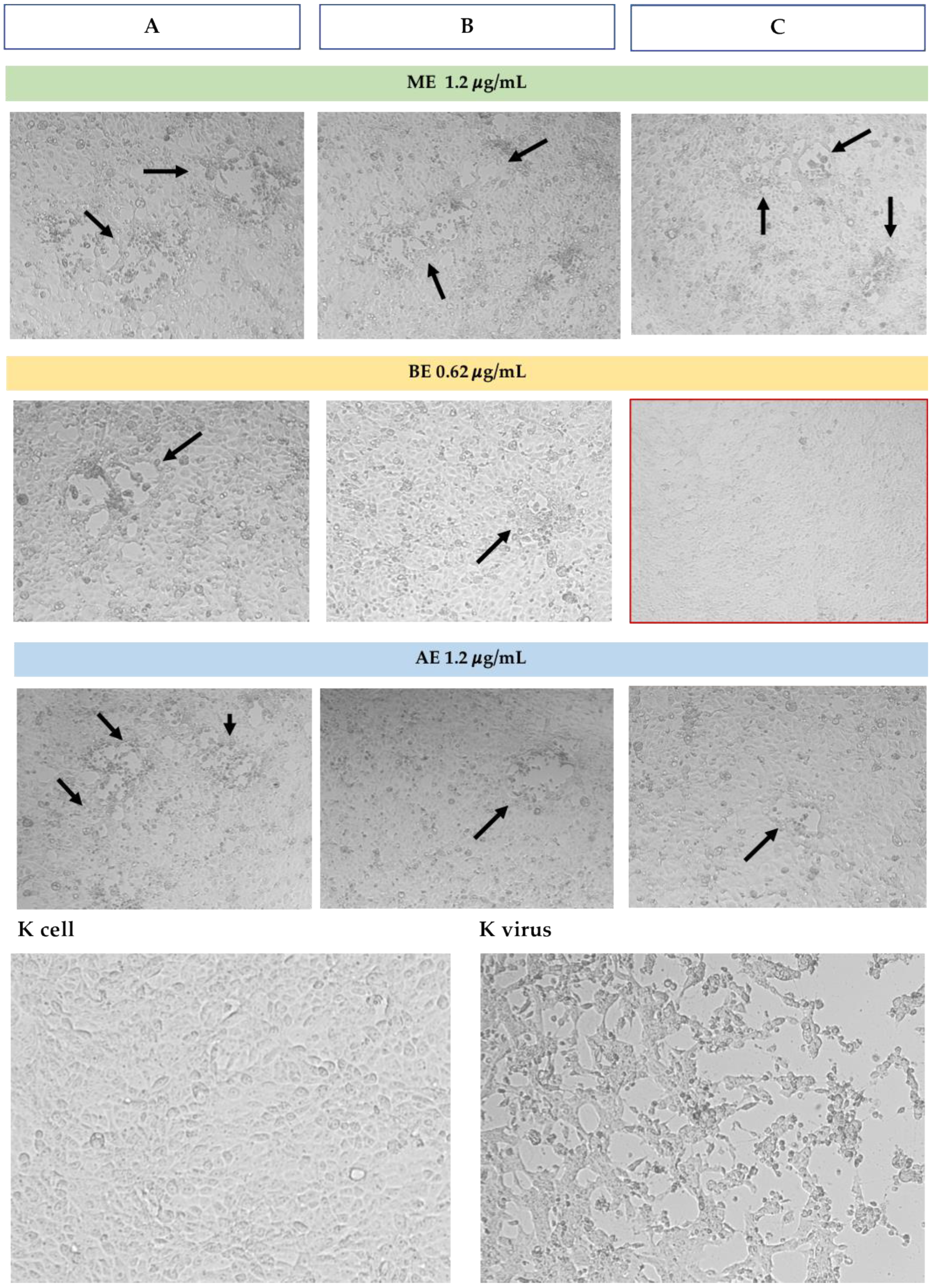 Microorganisms 13 00891 g005