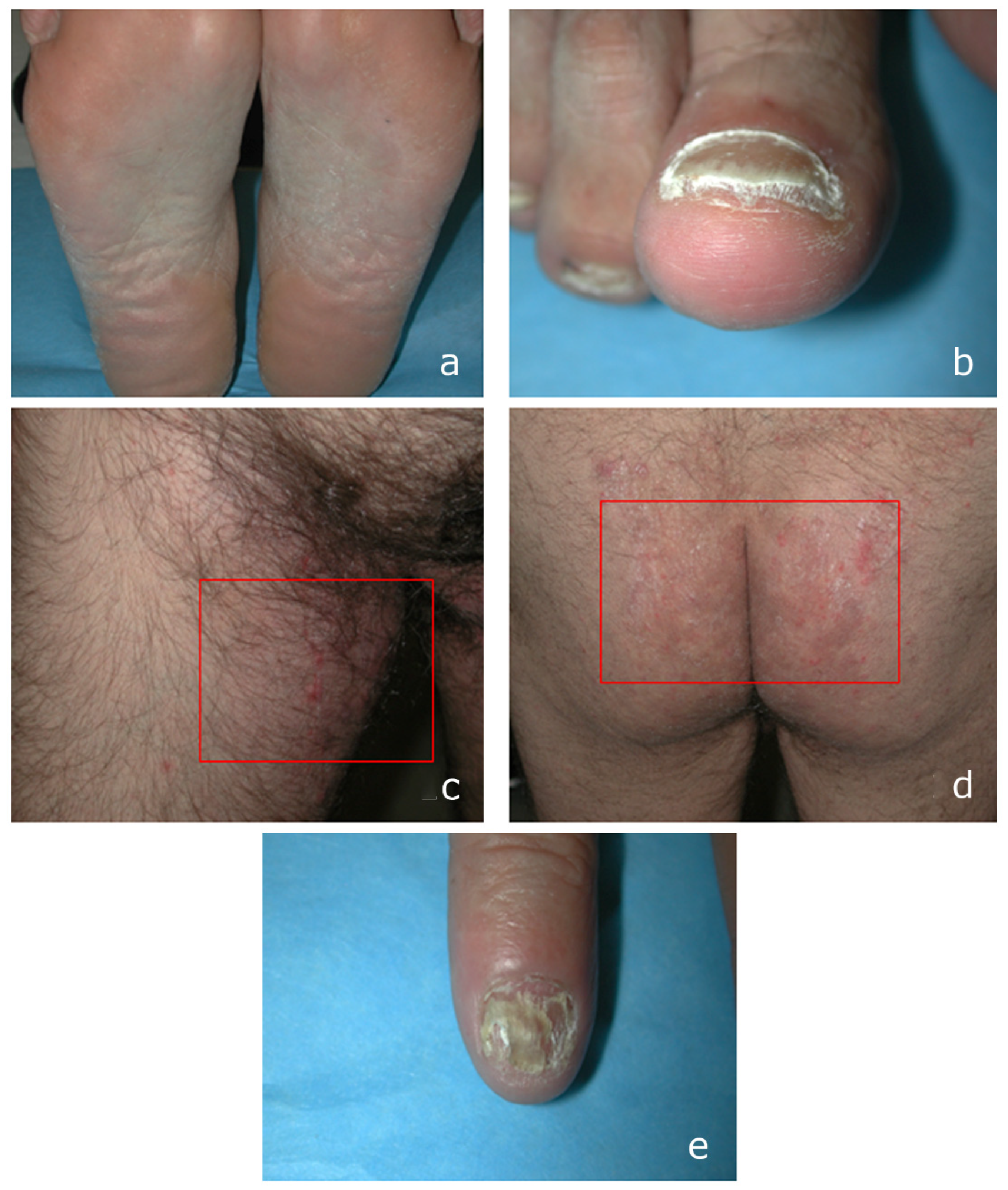 Microorganisms 13 00895 g001