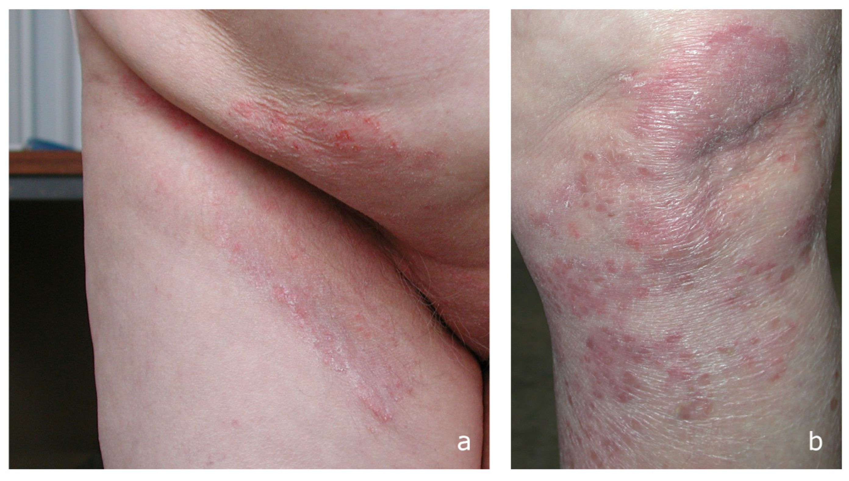 Microorganisms 13 00895 g002