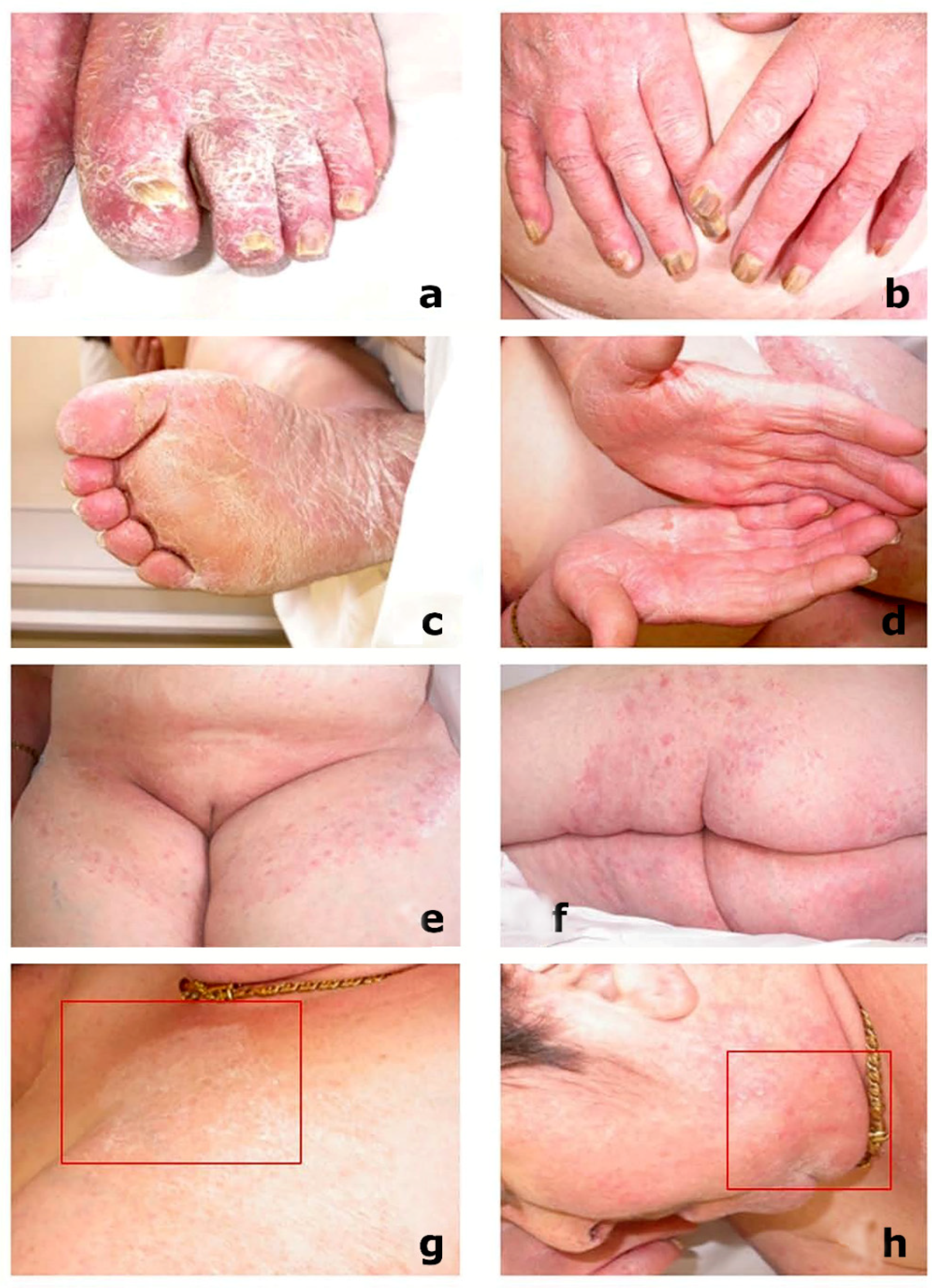 Microorganisms 13 00895 g004