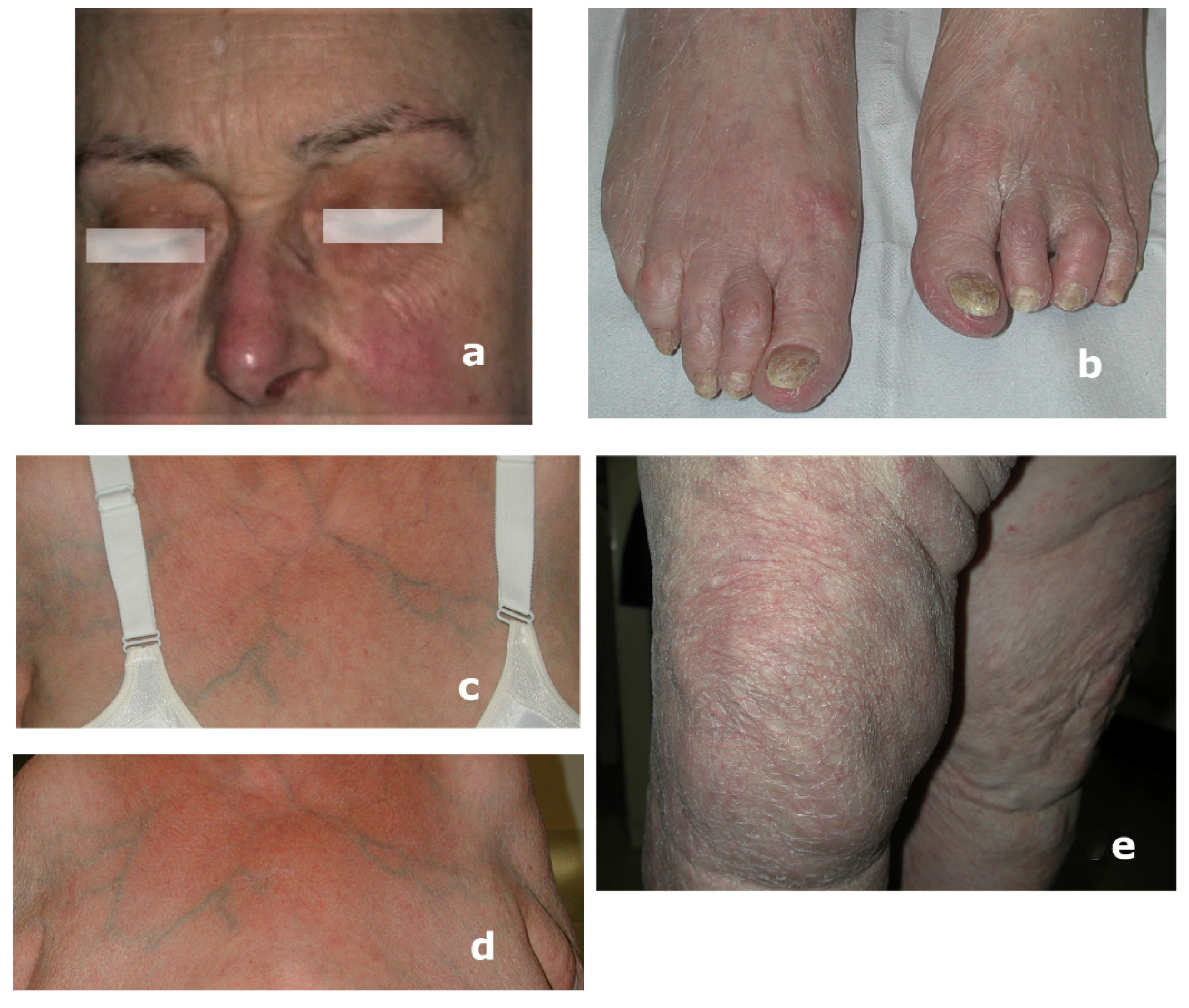 Microorganisms 13 00895 g005