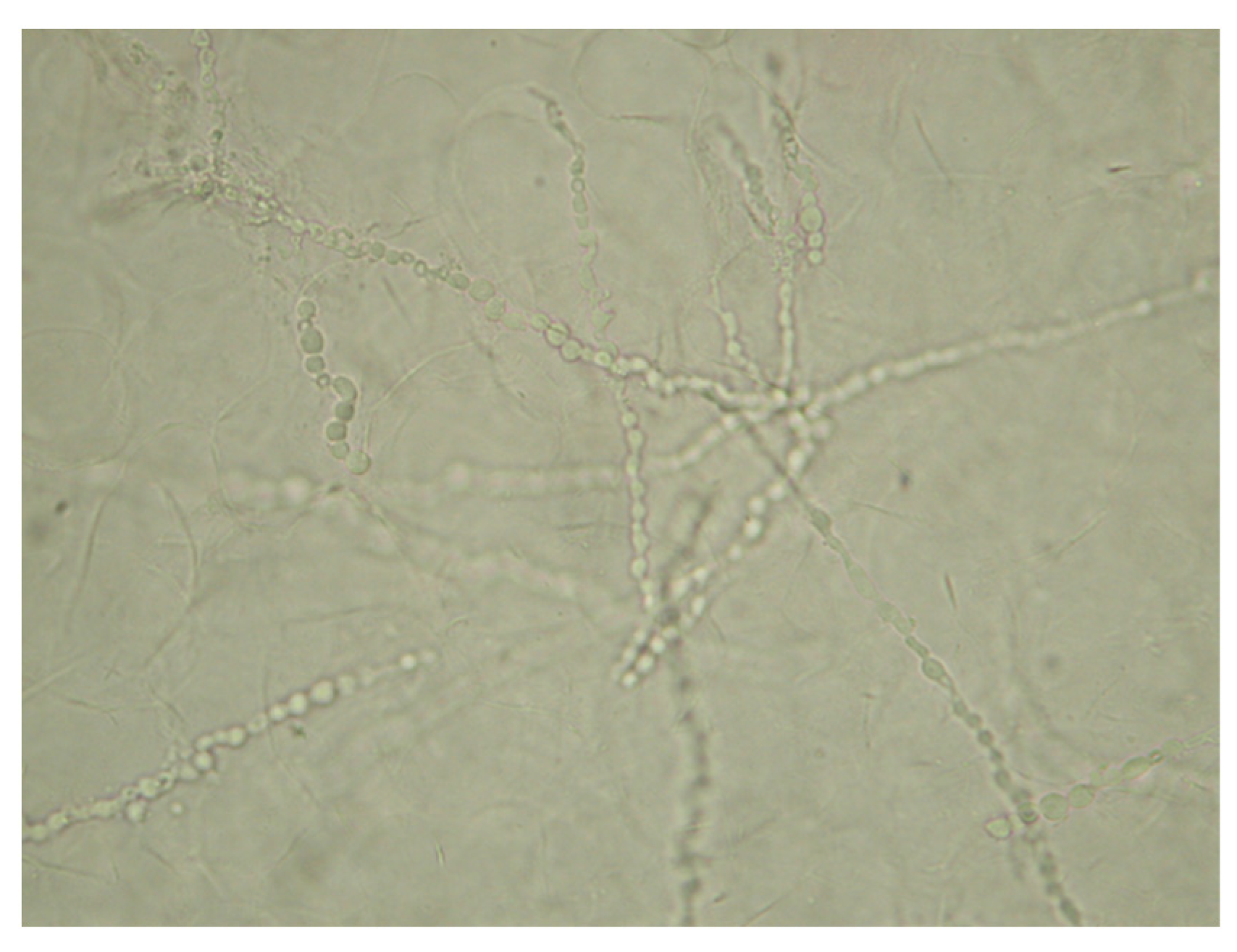 Microorganisms 13 00895 g006