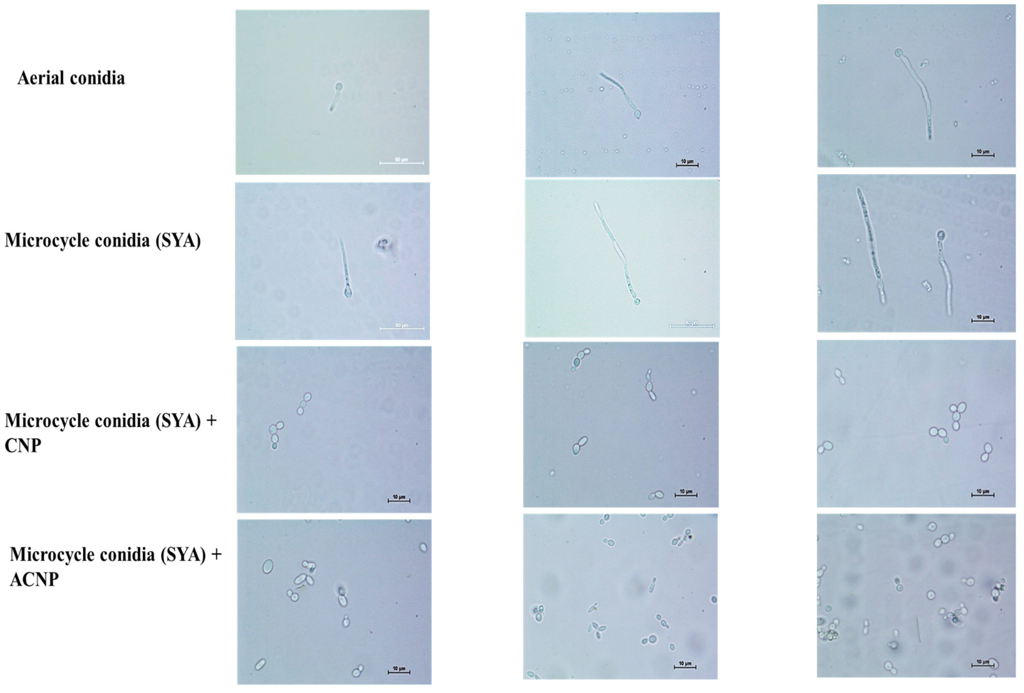 Microorganisms 13 00900 g006