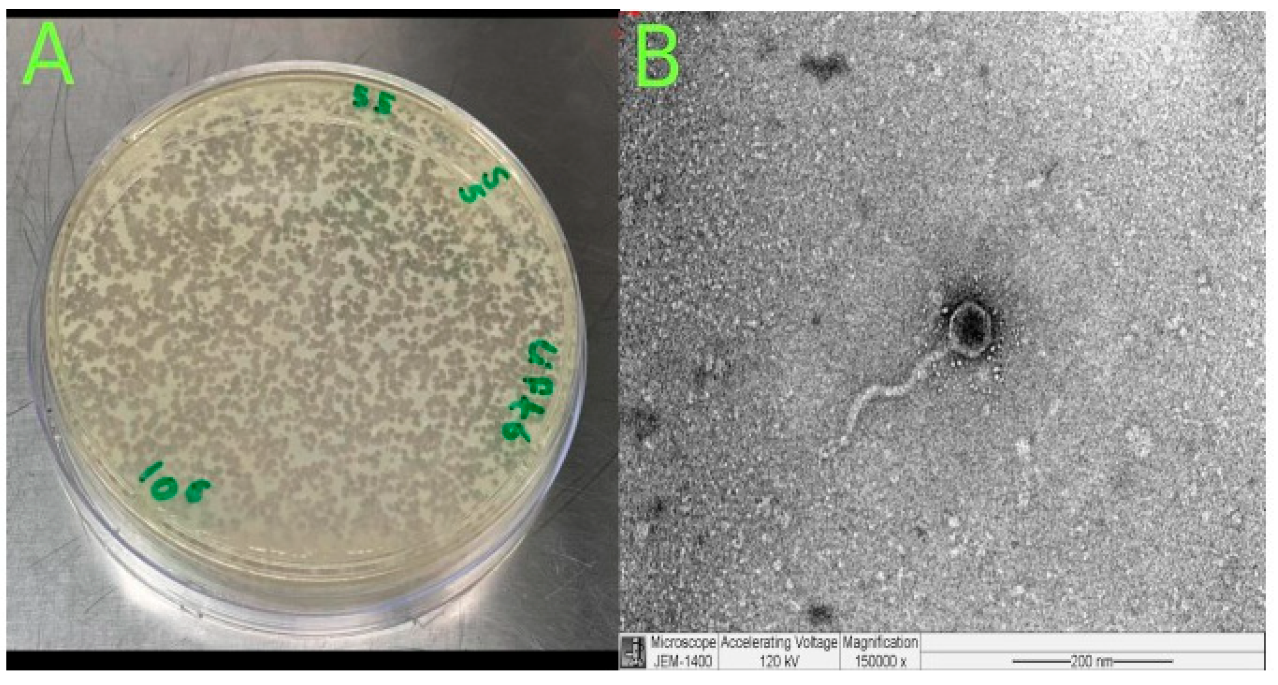 Microorganisms 13 00908 g002