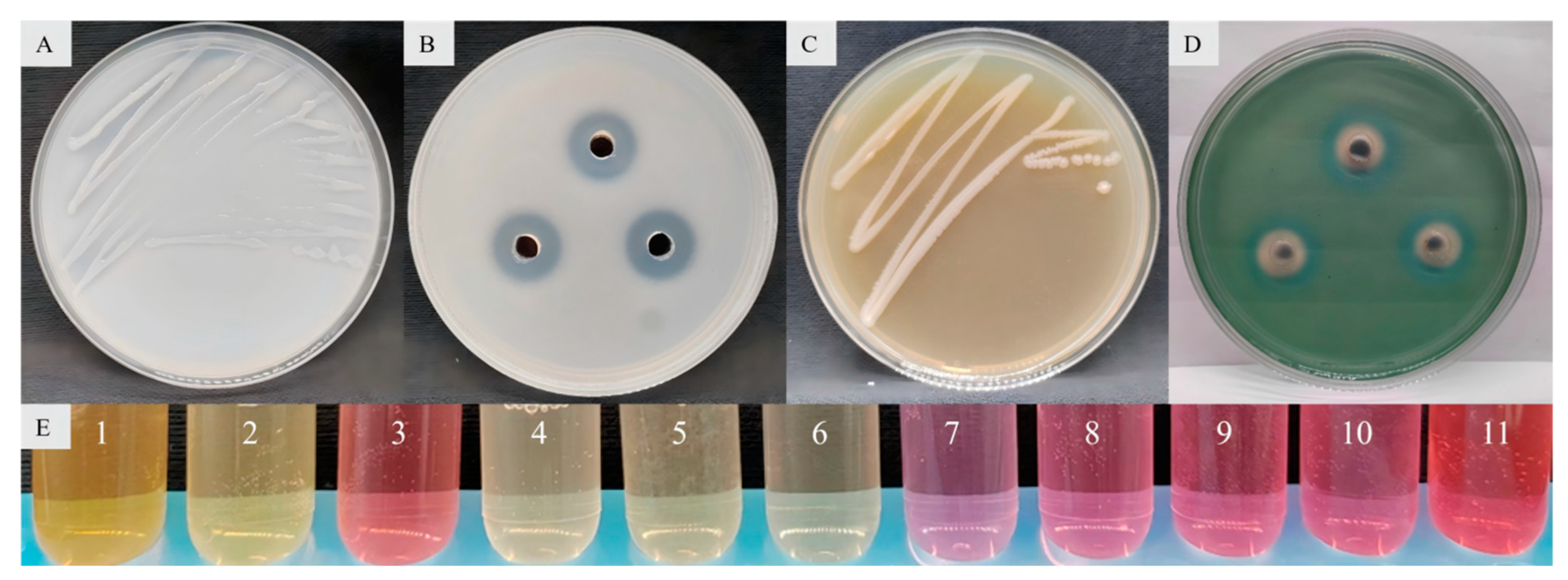 Microorganisms 13 01012 g005