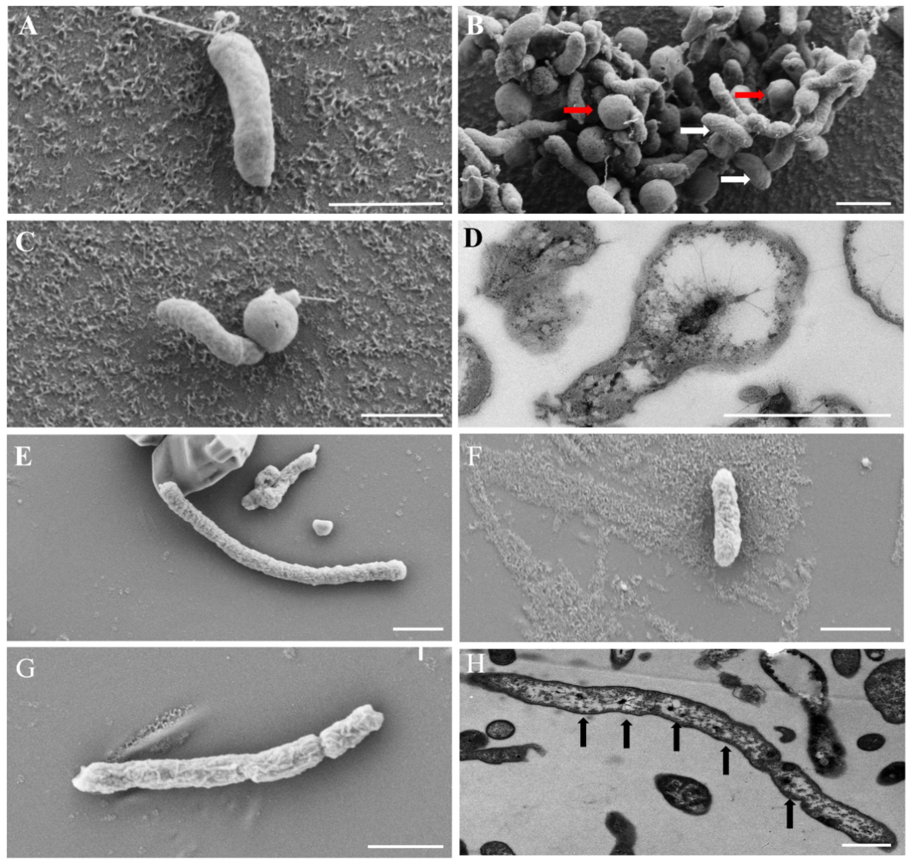 Microorganisms 13 01028 g004