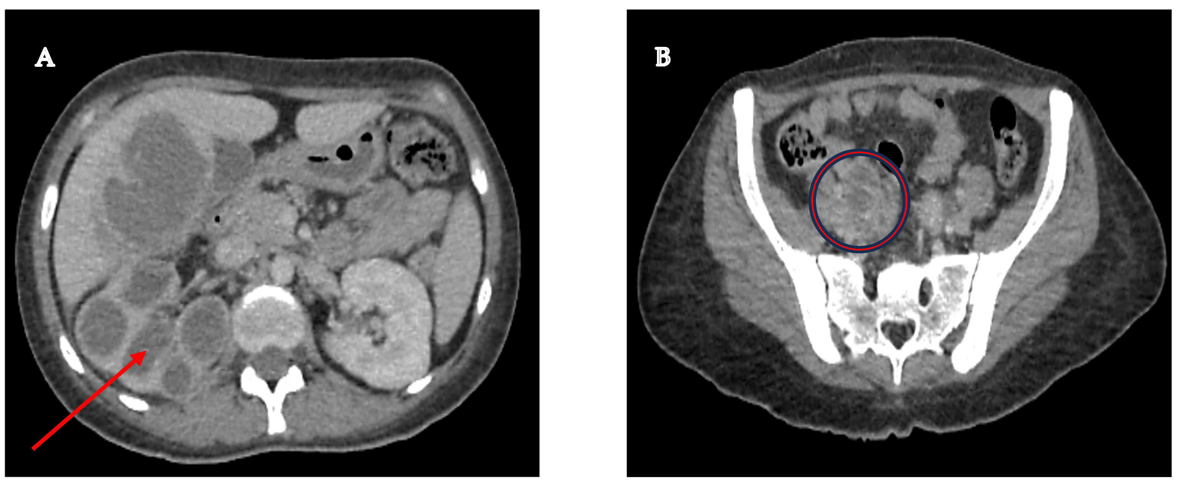 Microorganisms 13 01033 g001