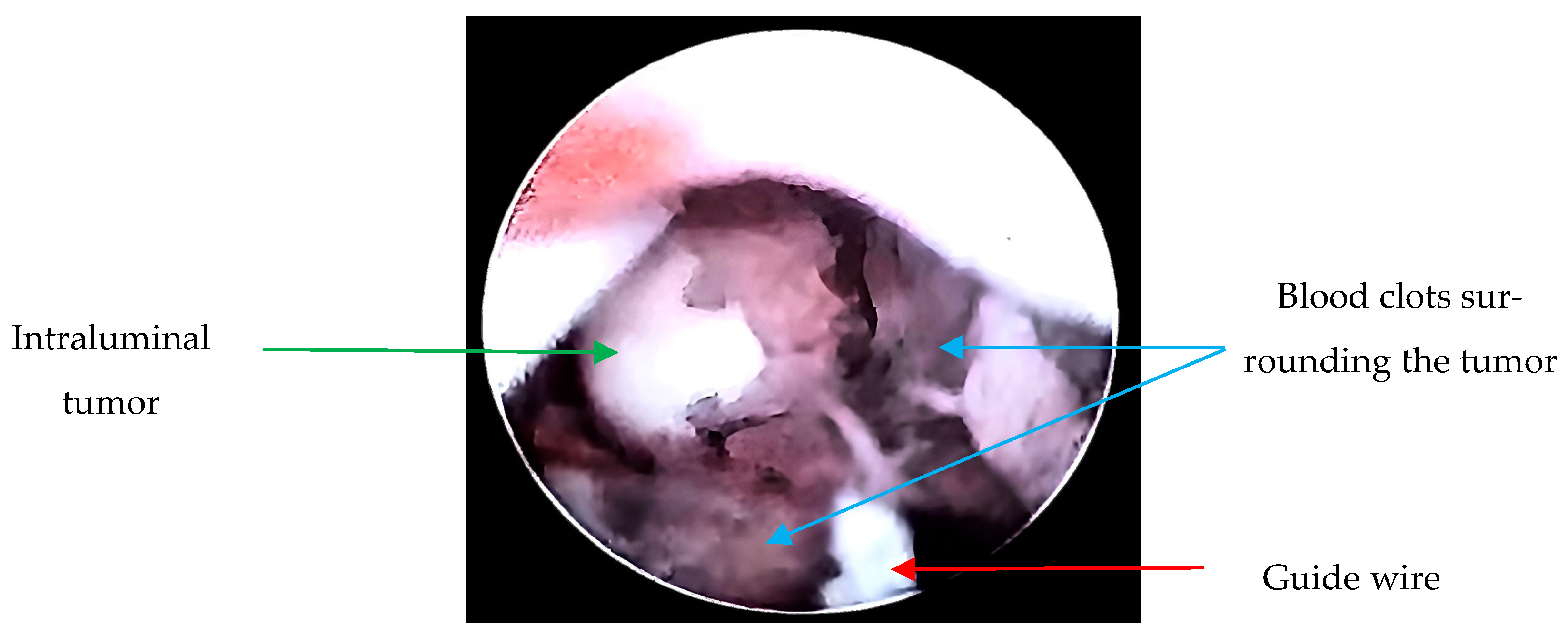 Microorganisms 13 01033 g002