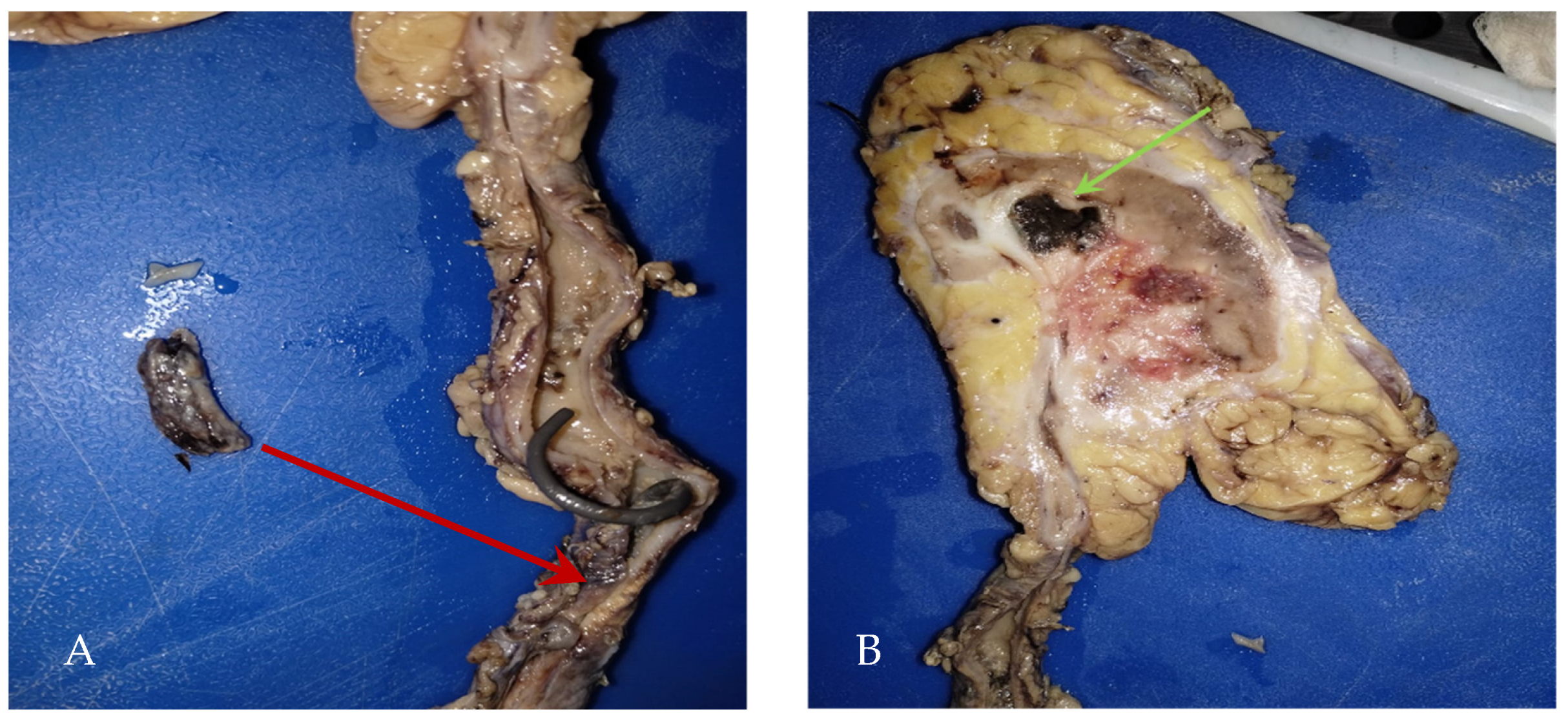 Microorganisms 13 01033 g003