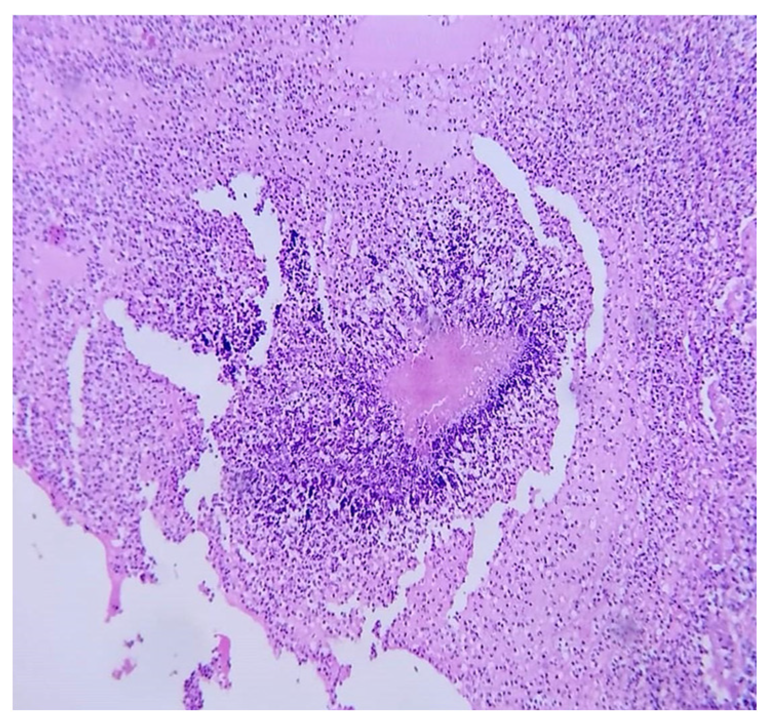 Microorganisms 13 01033 g004