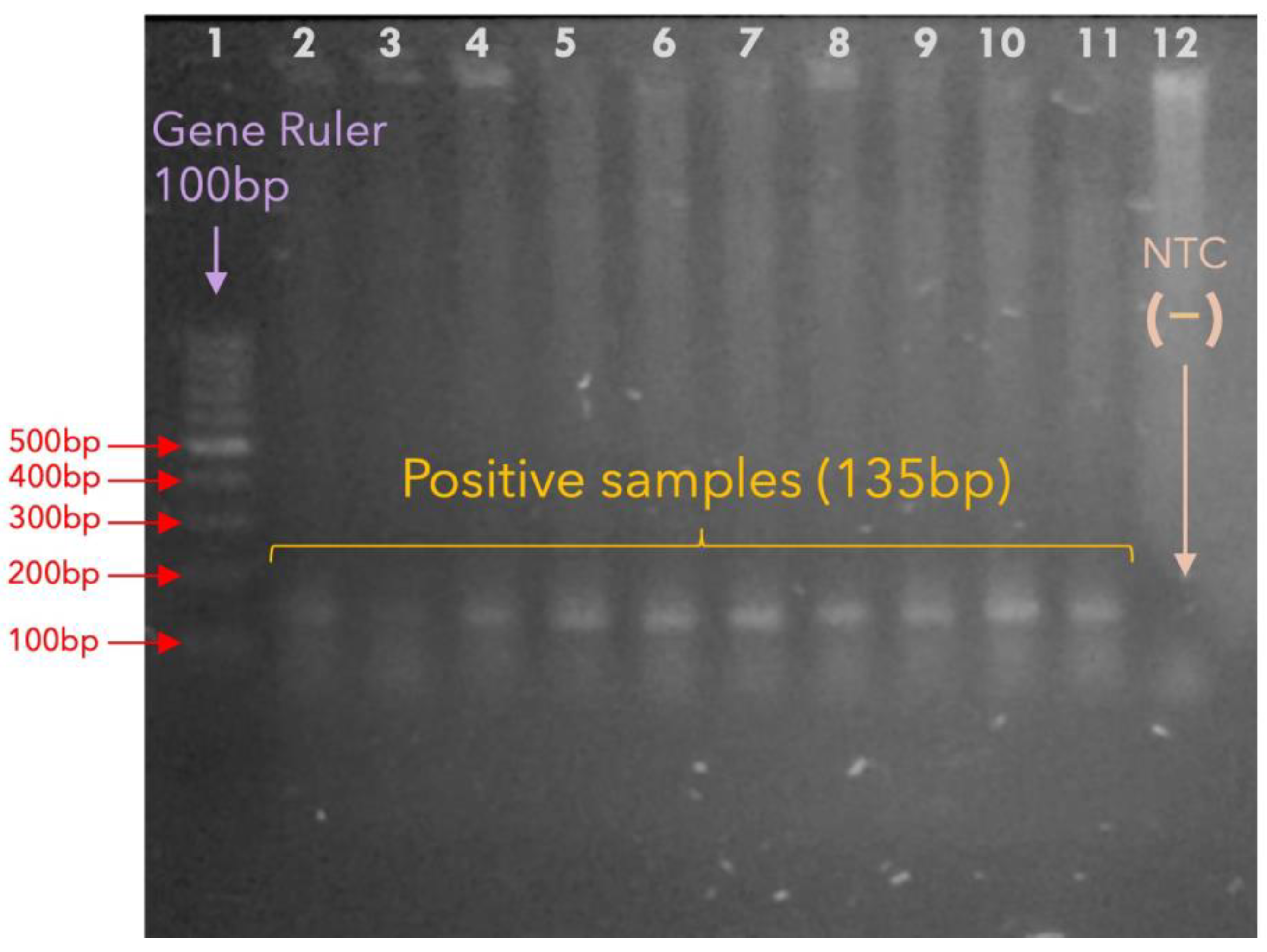 Microorganisms 13 01069 g001