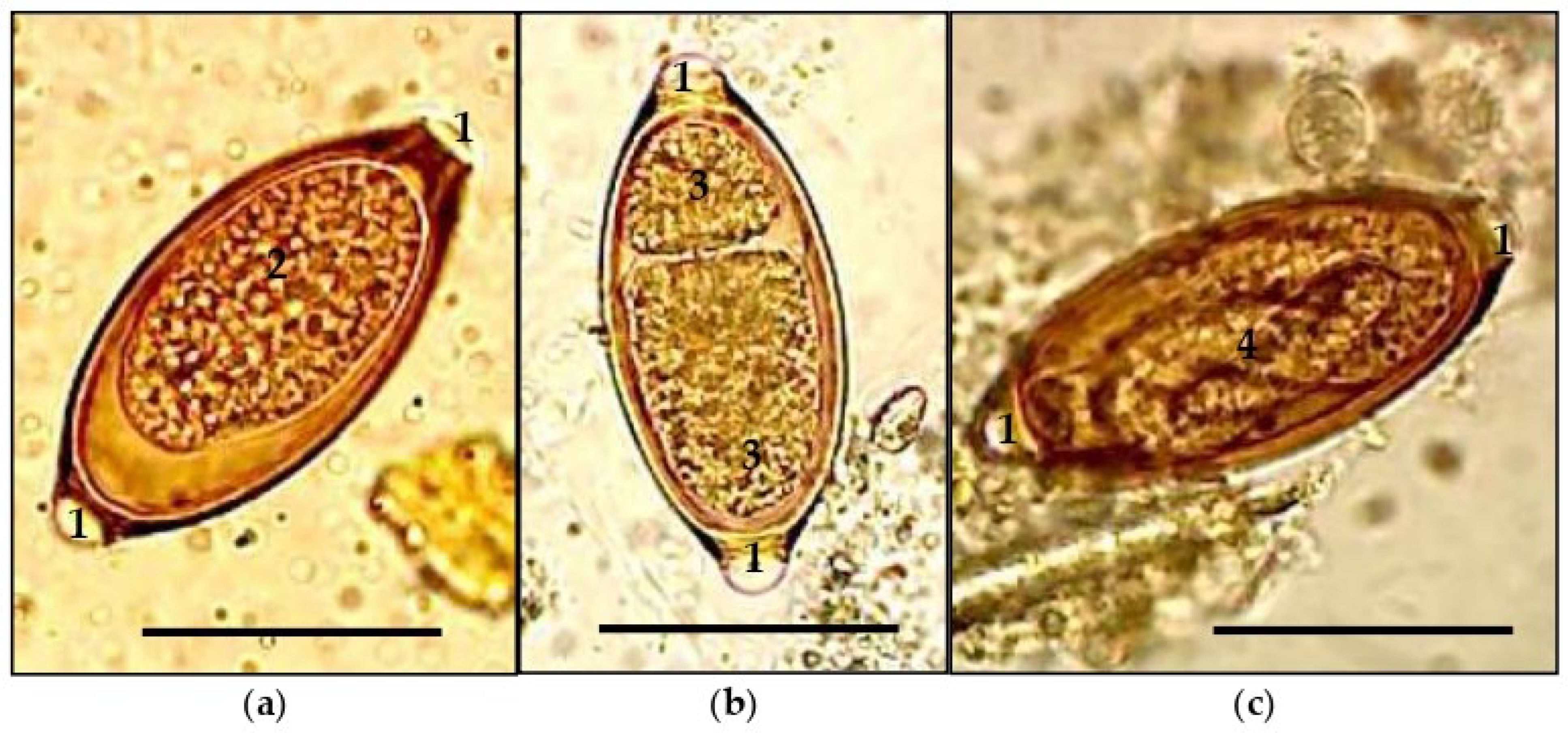 Microorganisms 13 01165 g004