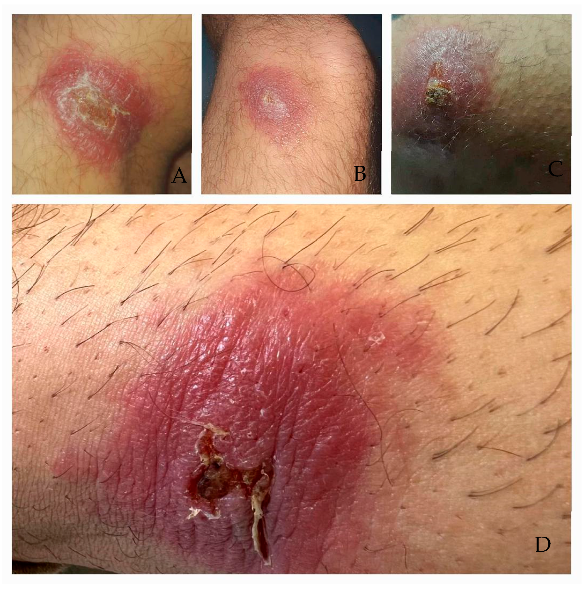 Microorganisms 13 01207 g001