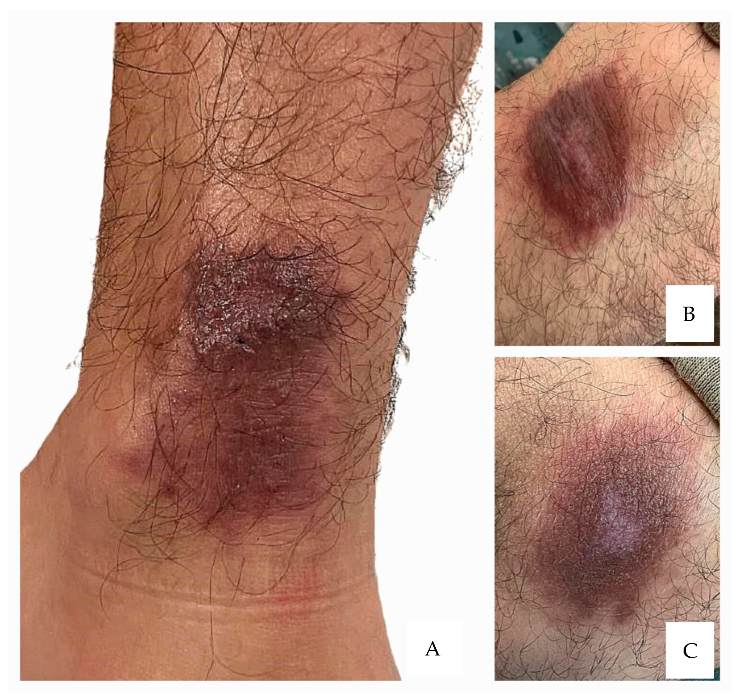 Microorganisms 13 01207 g002