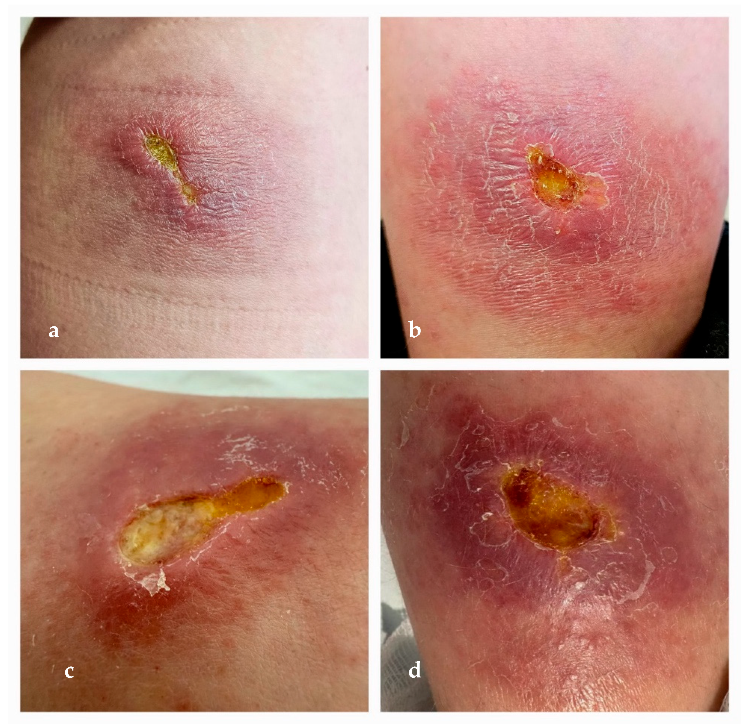 Microorganisms 13 01207 g004