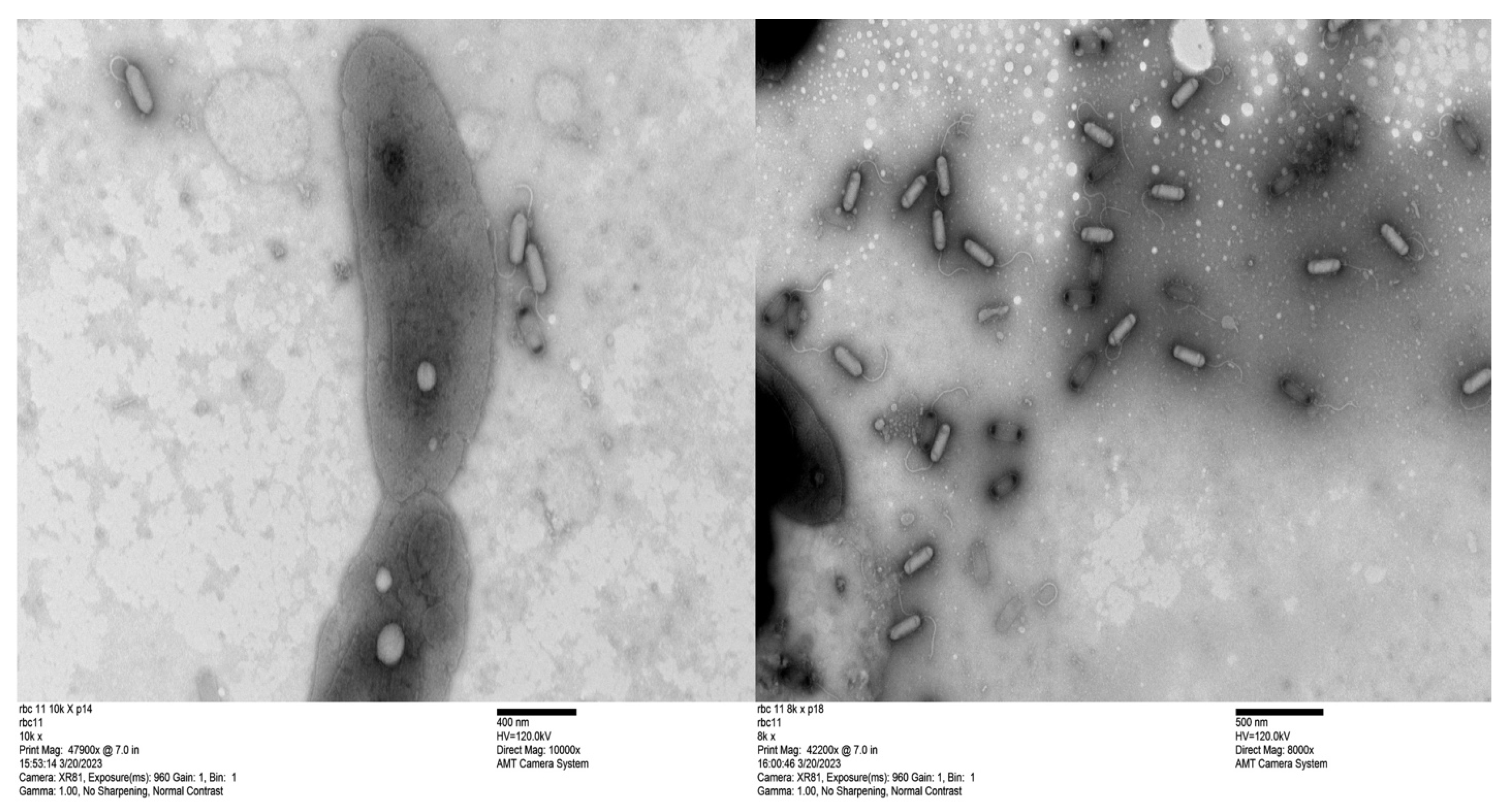 Microorganisms 13 01239 g003