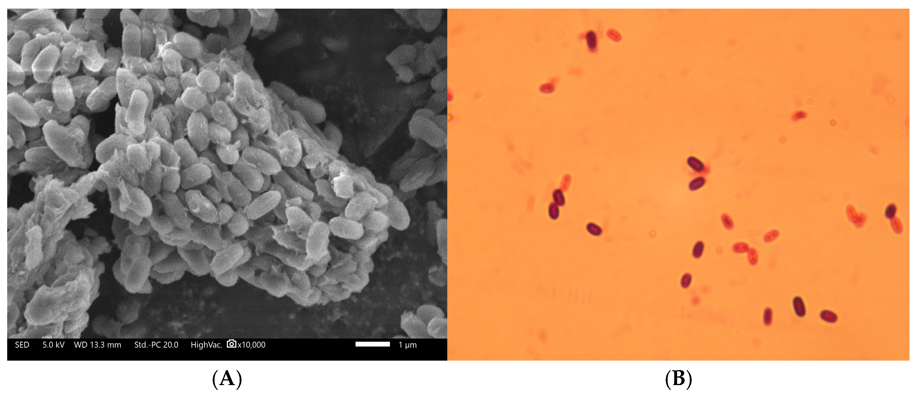 Microorganisms 13 01244 g002 Microorganisms 13 01244 g002