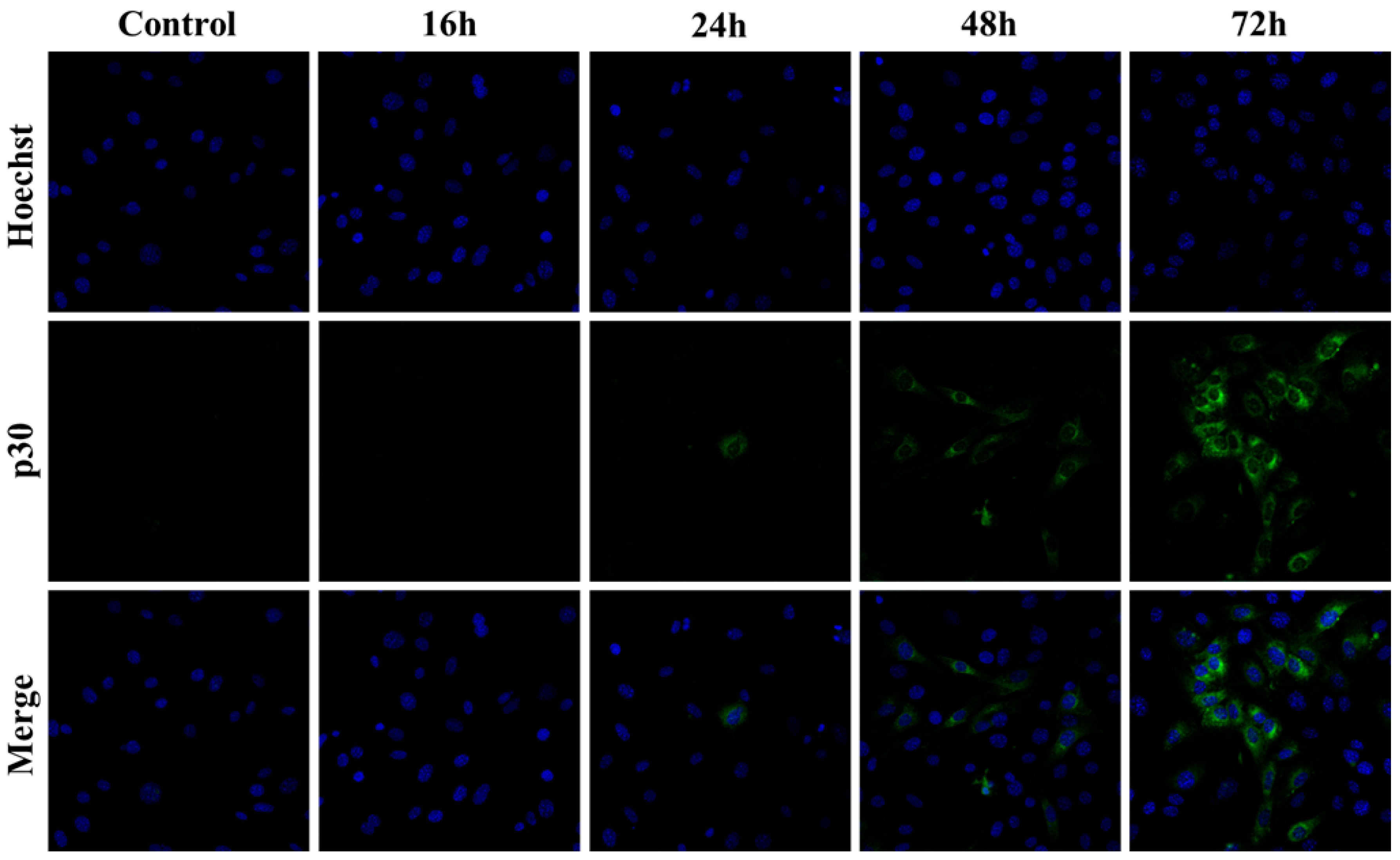 Microorganisms 13 01268 g005