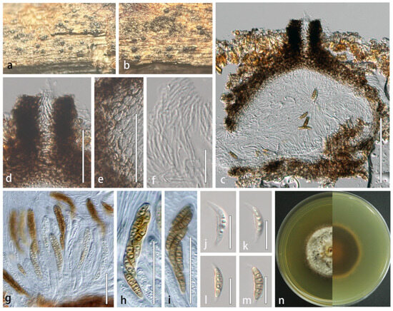 Microorganisms 13 01296 g004