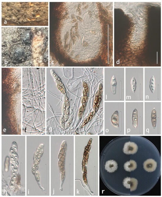 Microorganisms 13 01296 g005