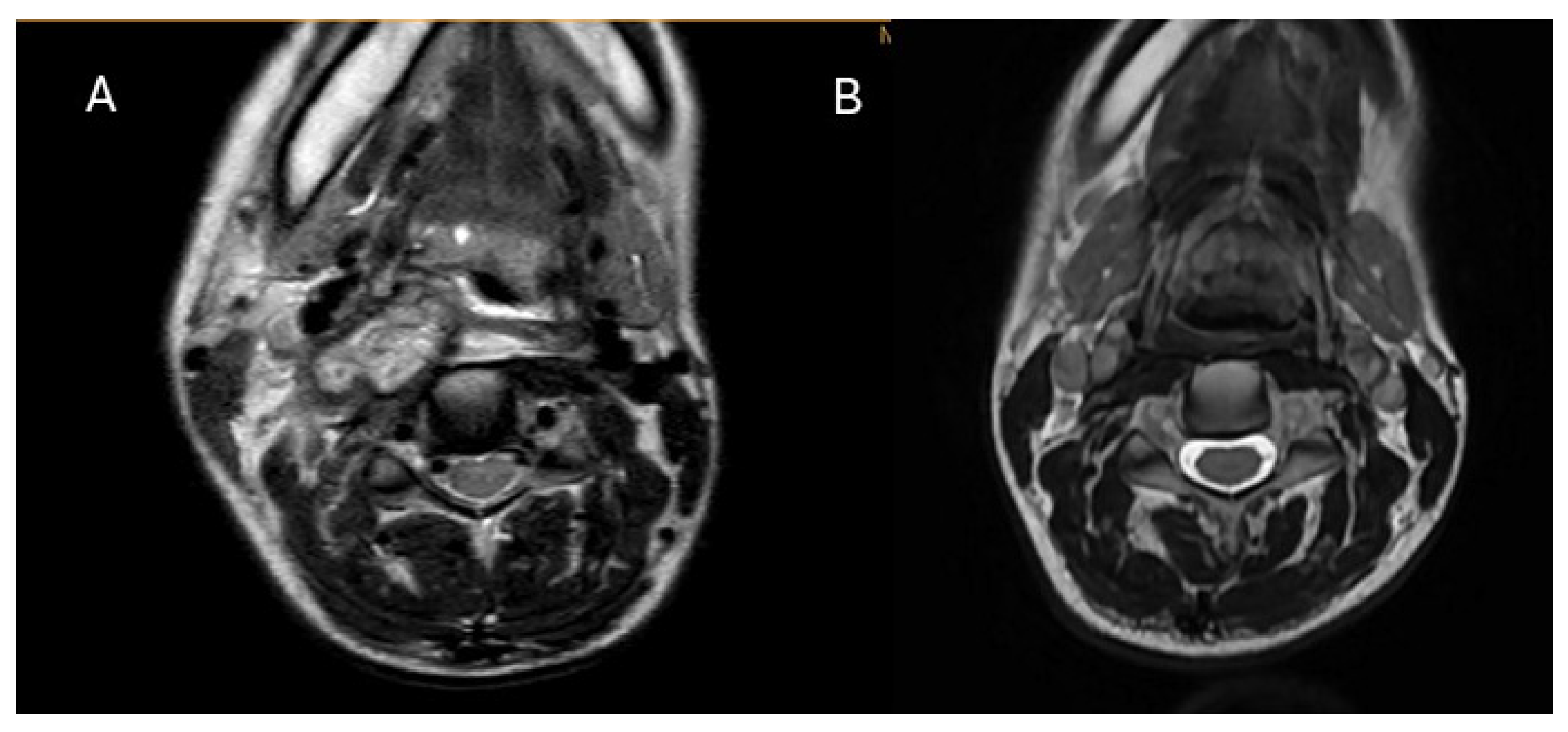 Microorganisms 13 01855 g001