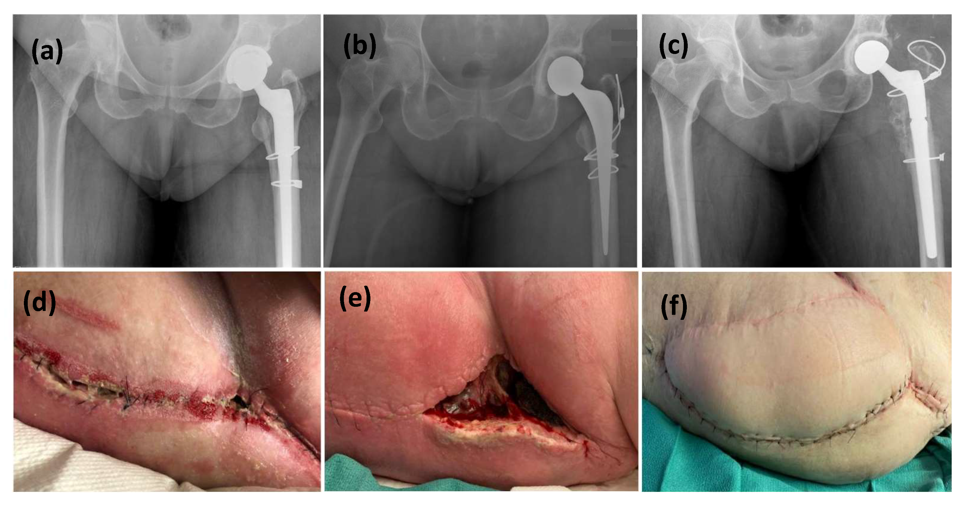 Microorganisms 13 01962 g002