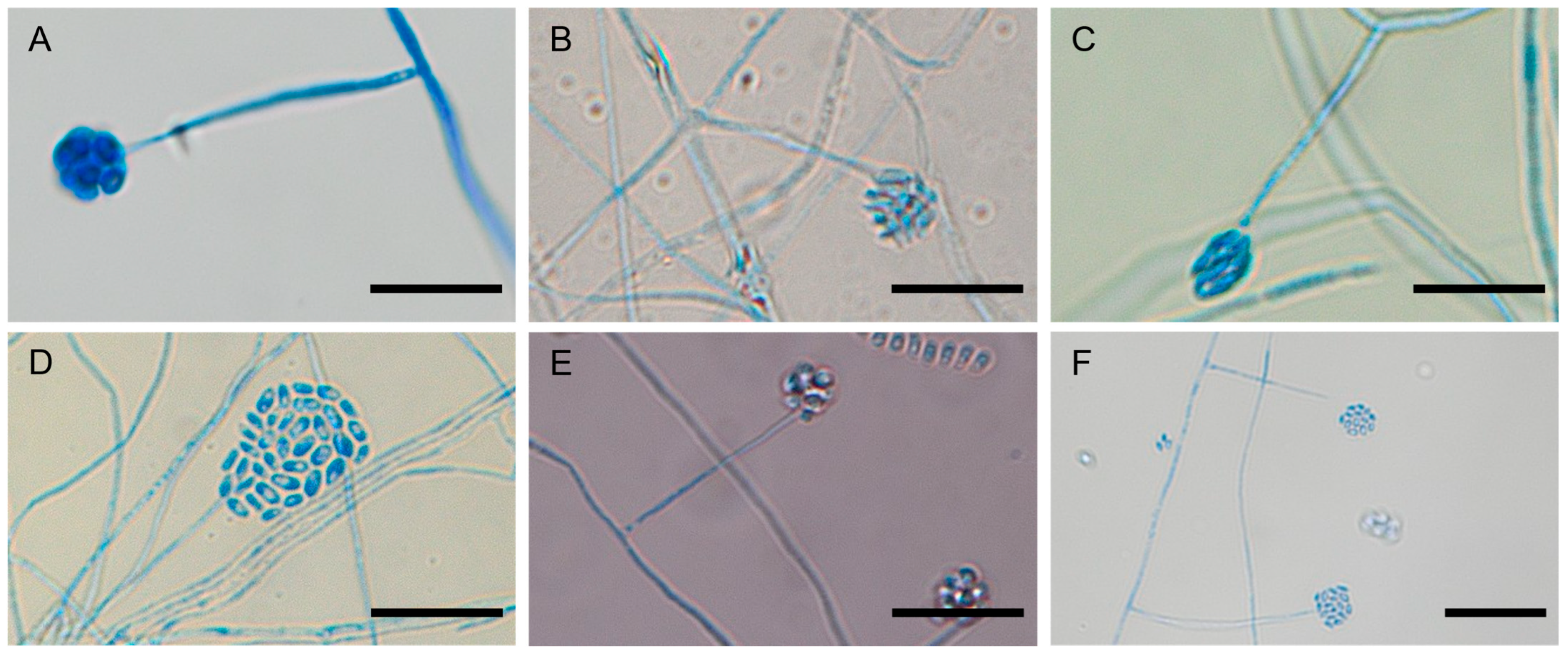 Microorganisms 13 02035 g005