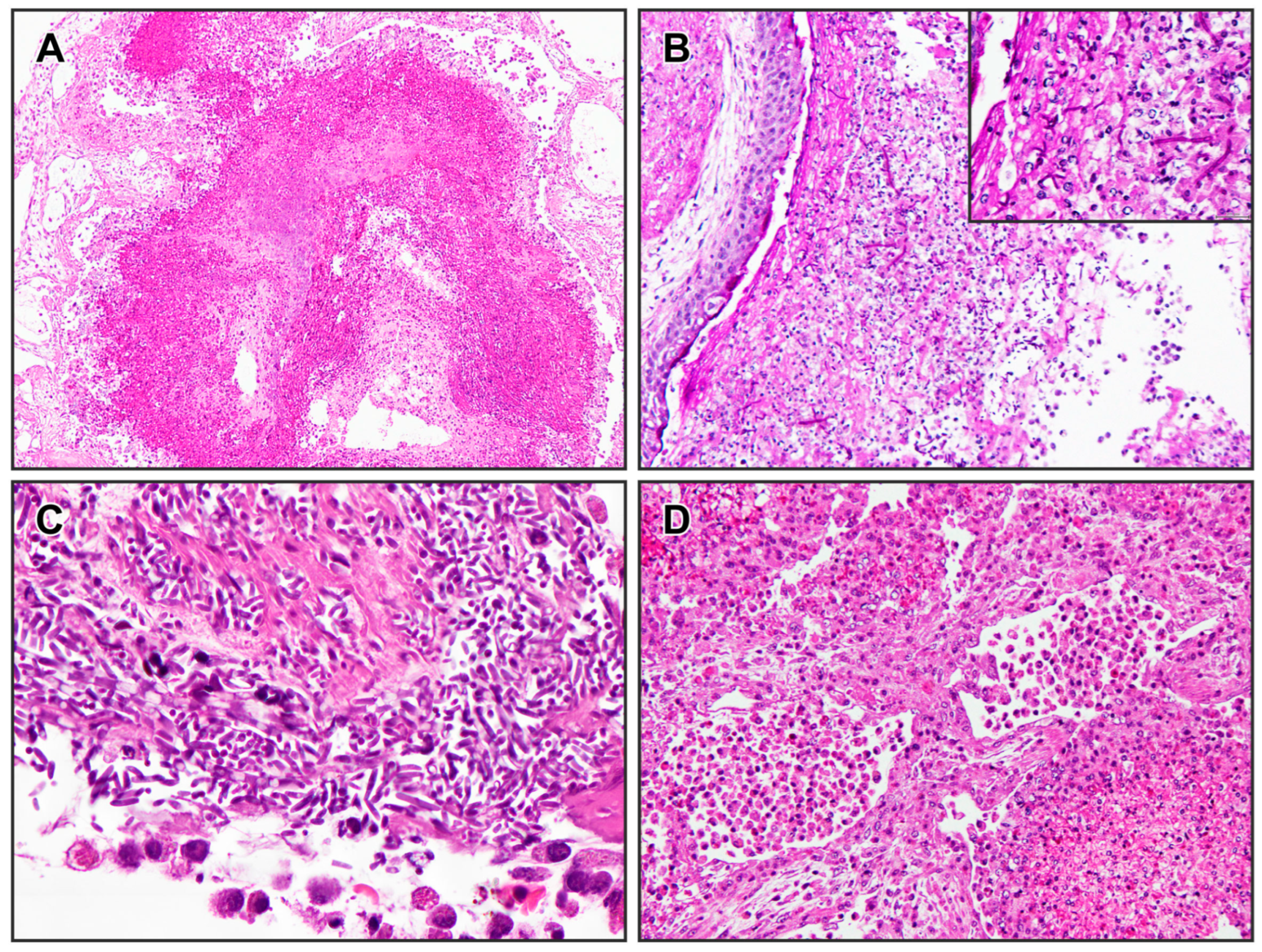 Microorganisms 13 02092 g005