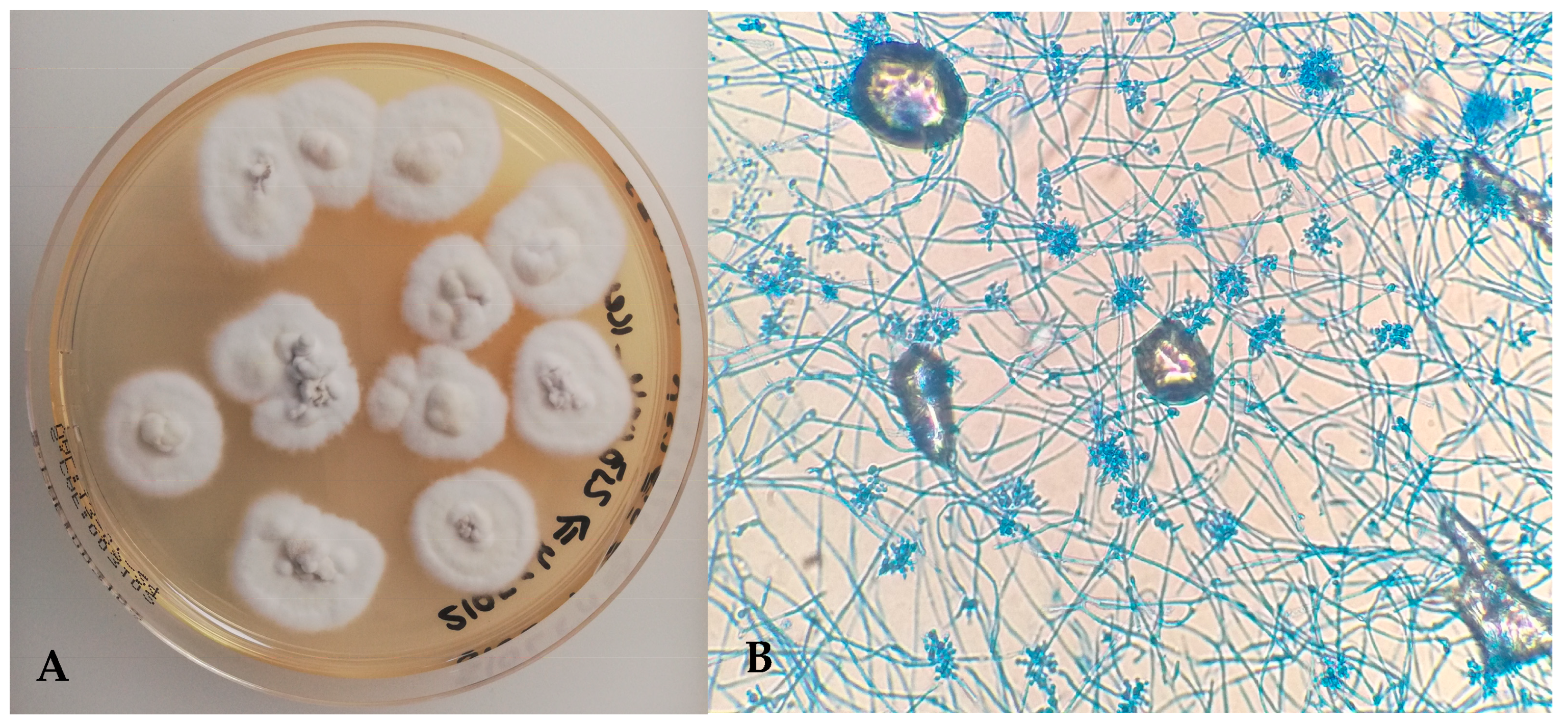 Microorganisms 13 02092 g006