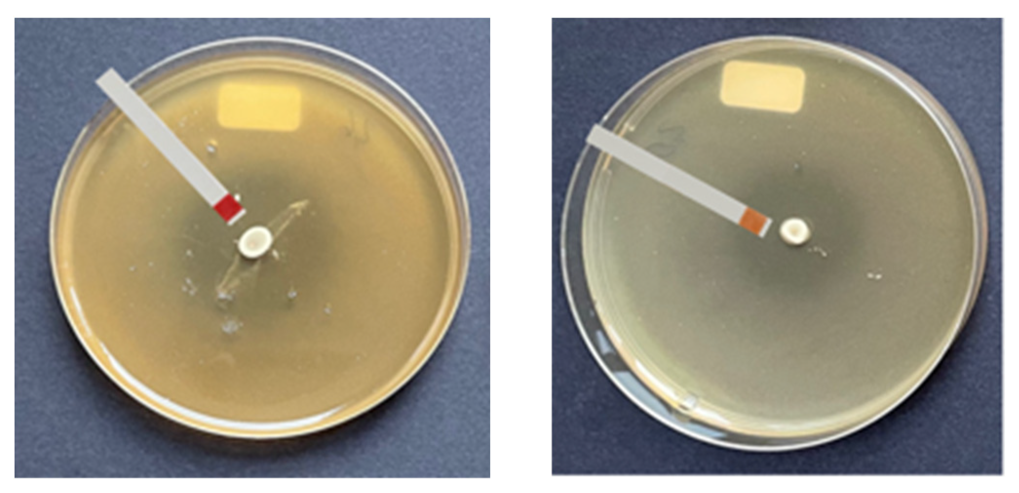 Microorganisms 13 02244 g004