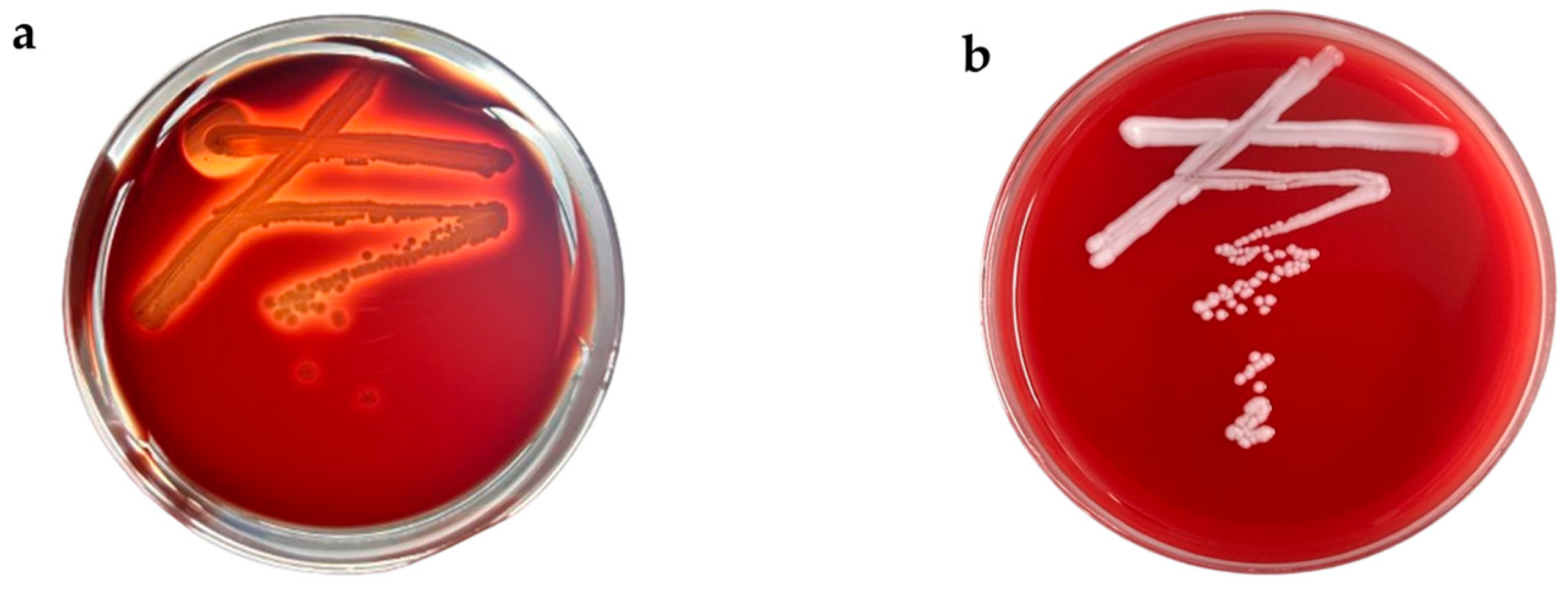 Microorganisms 13 02251 g003