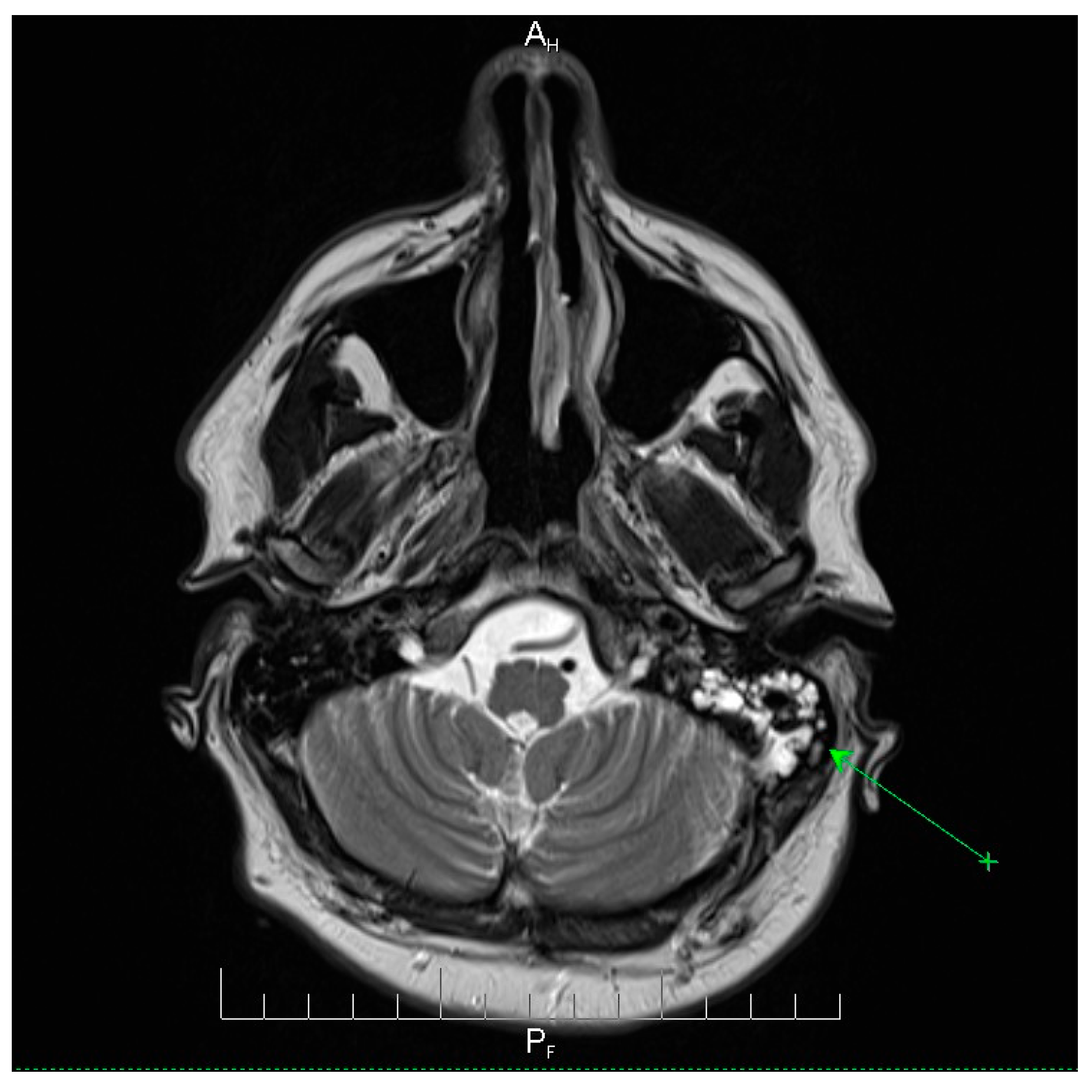 Microorganisms 13 02315 g002 Microorganisms 13 02315 g002