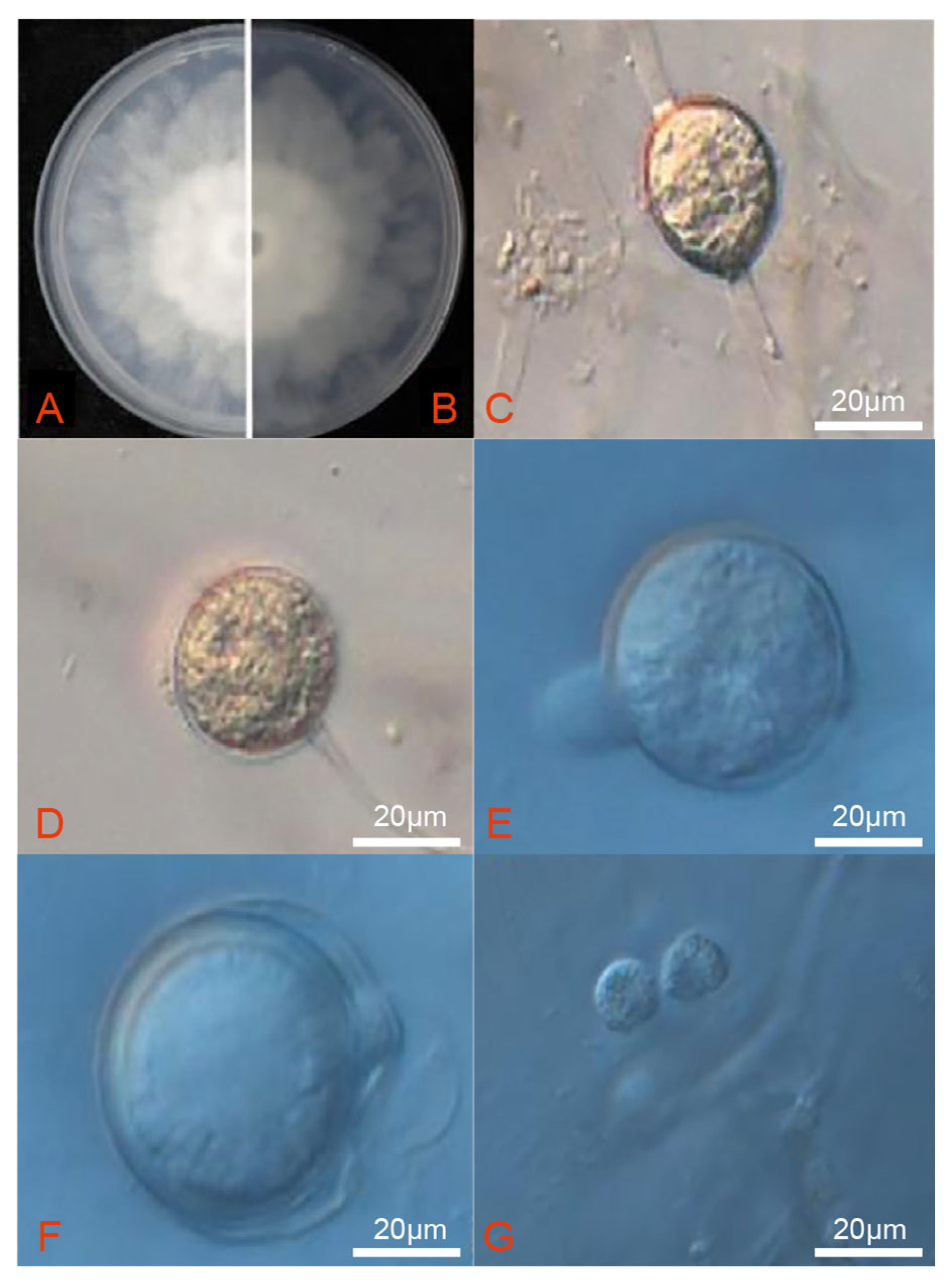 Microorganisms 13 02417 g003 Microorganisms 13 02417 g003