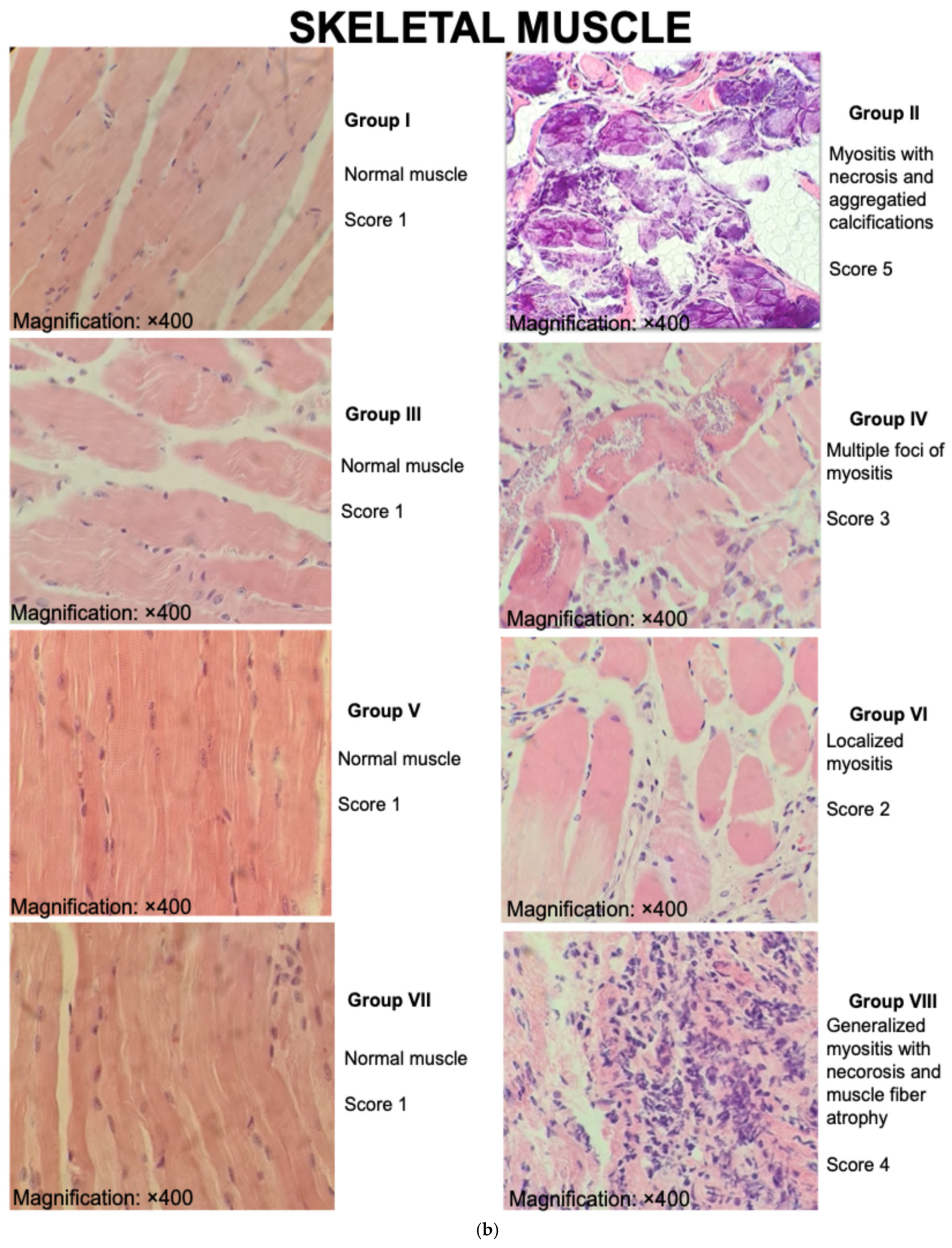 Microorganisms 13 02447 g009b