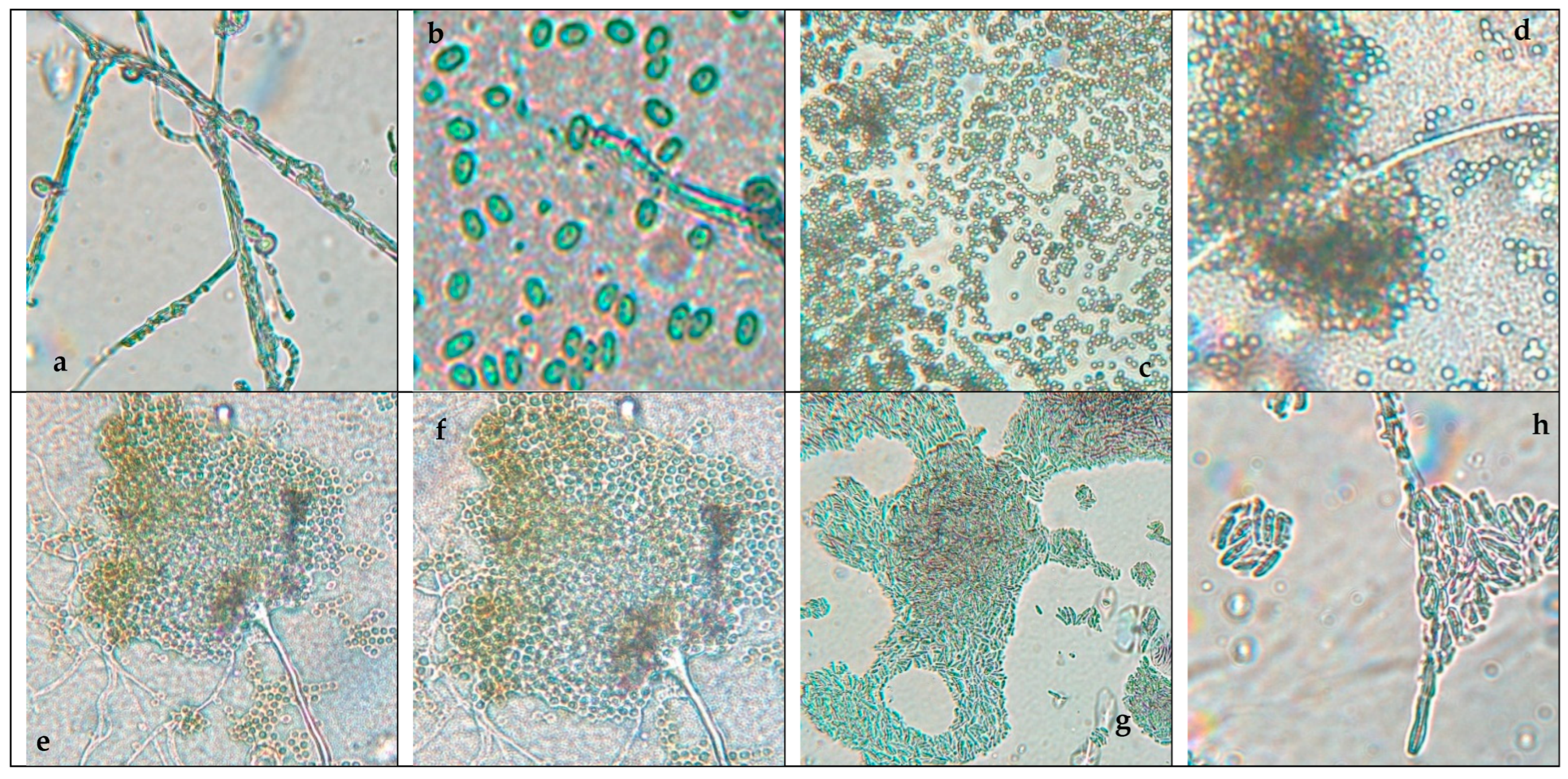 Microorganisms 13 02477 g002 Microorganisms 13 02477 g002