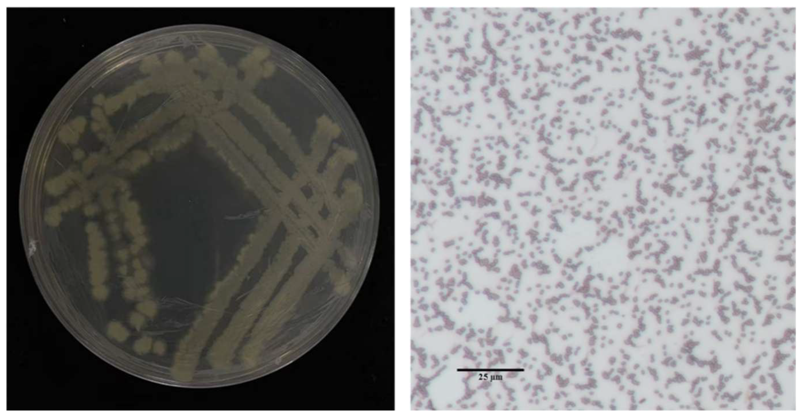 Microorganisms 13 02511 g004