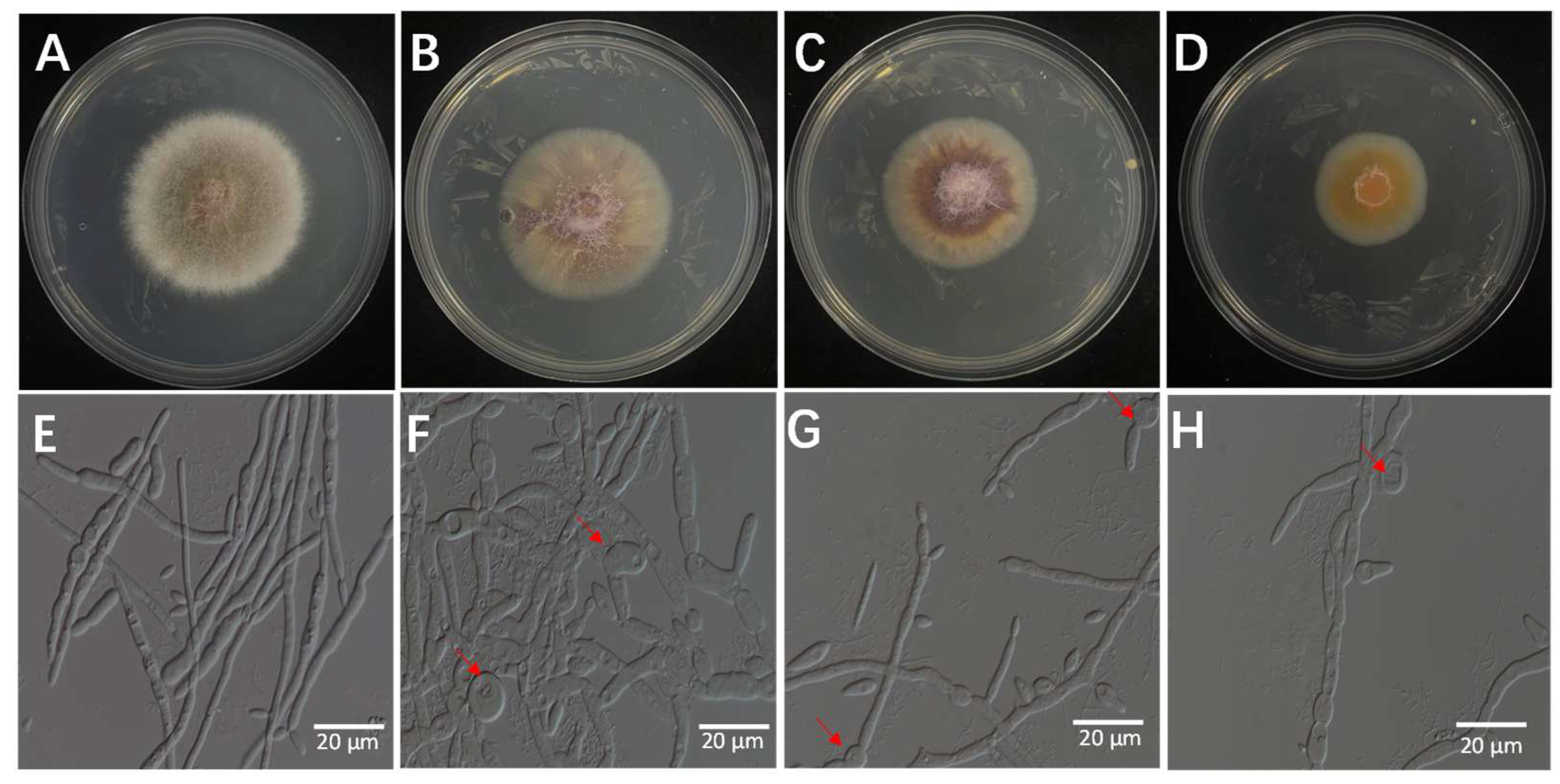 Microorganisms 13 02511 g009