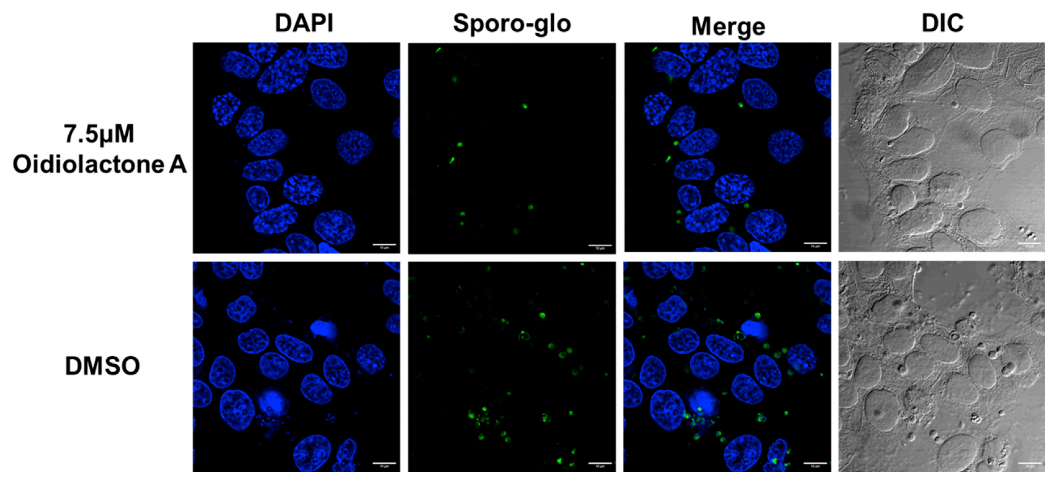 Microorganisms 13 02527 g003 Microorganisms 13 02527 g003