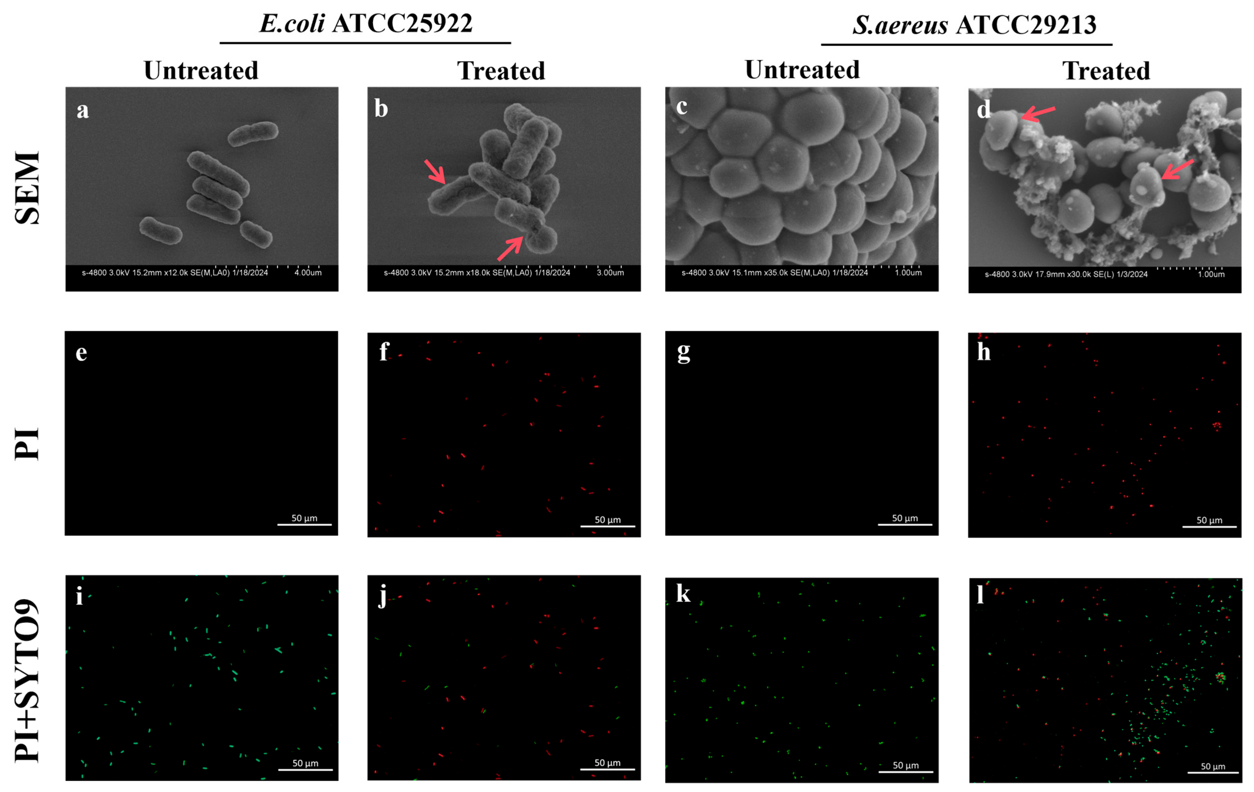 Microorganisms 13 02657 g005 Microorganisms 13 02657 g005