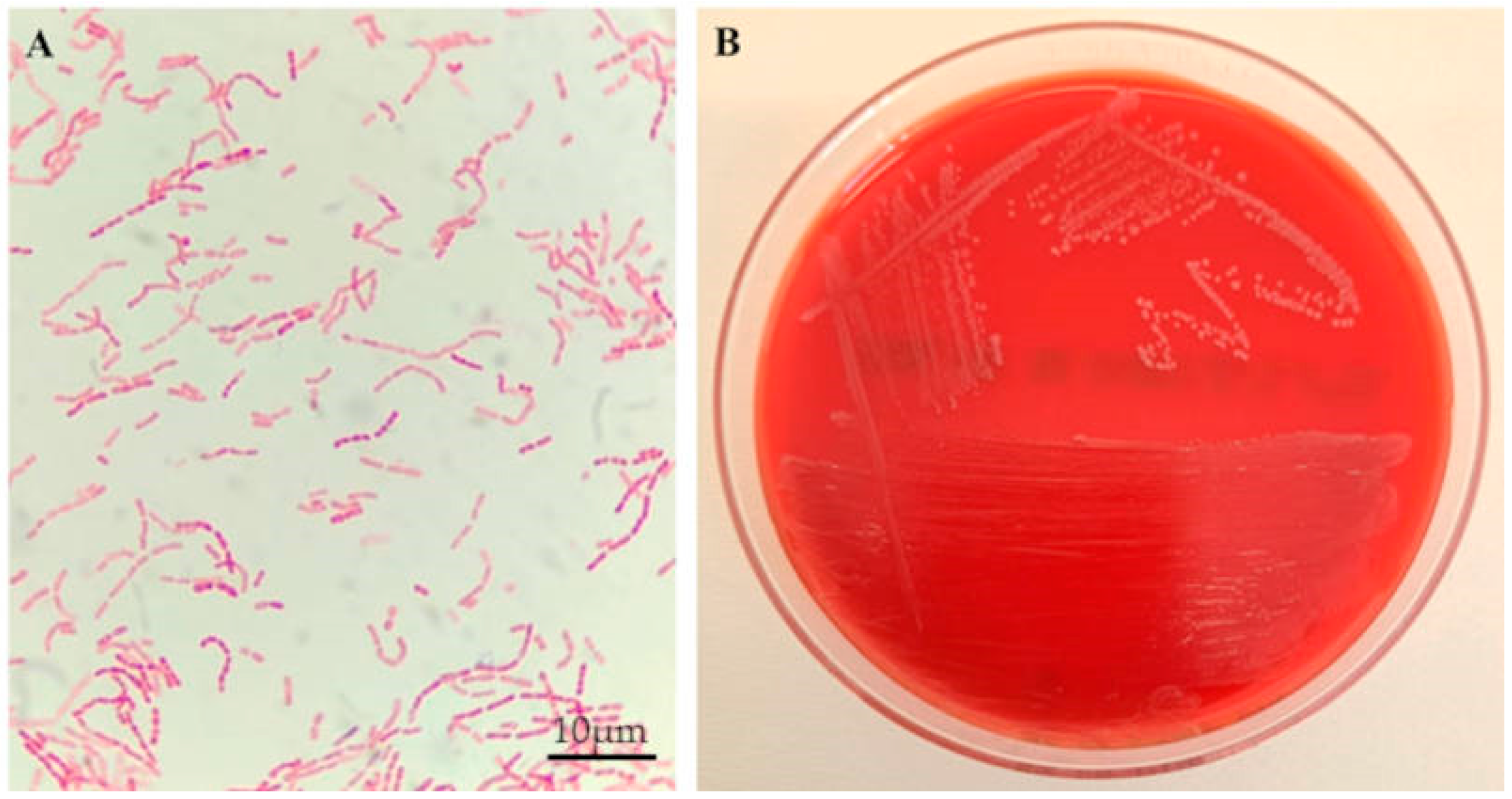 Microorganisms 13 02699 g001 Microorganisms 13 02699 g001
