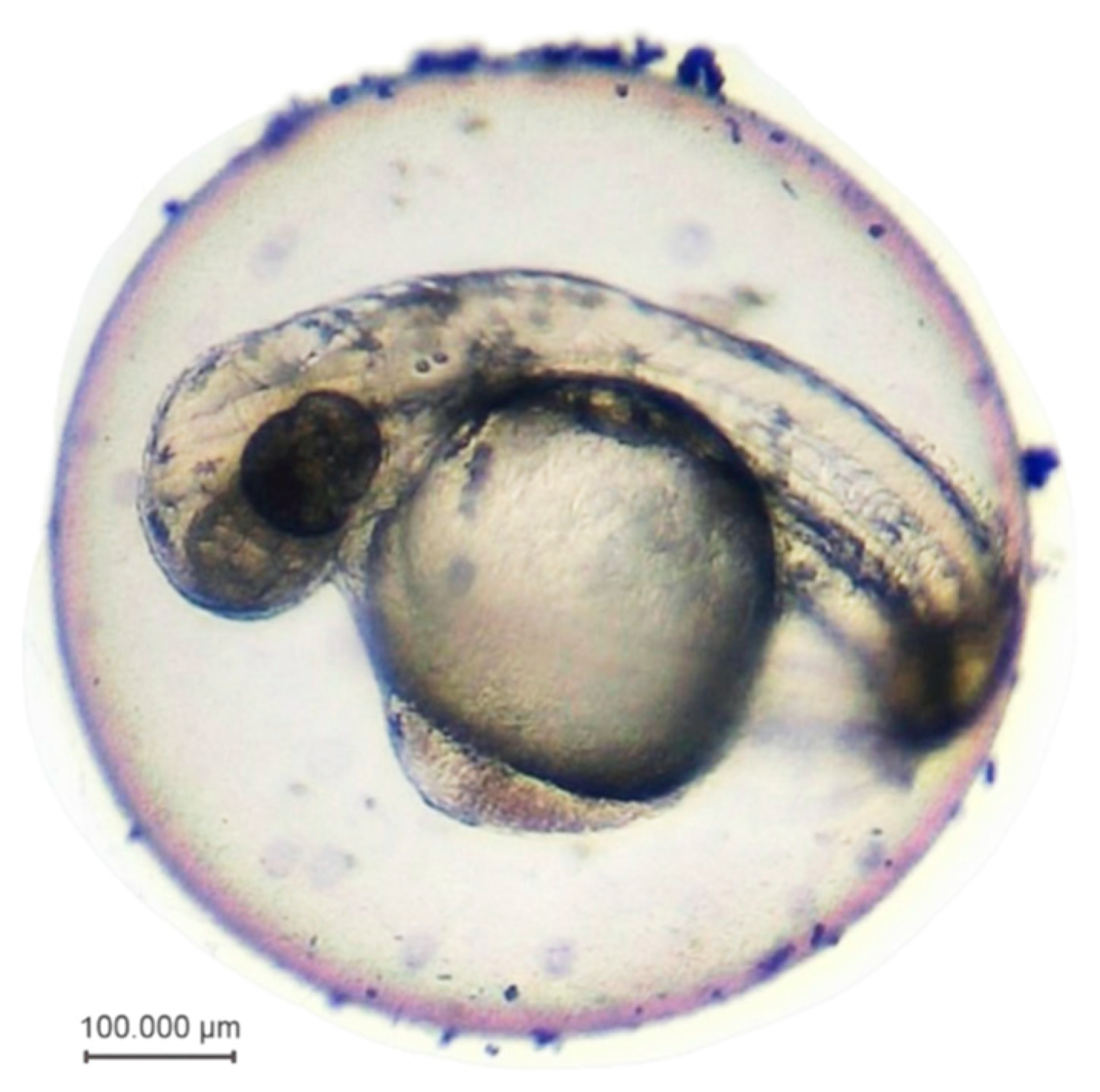 Microplastics 03 00044 g004
